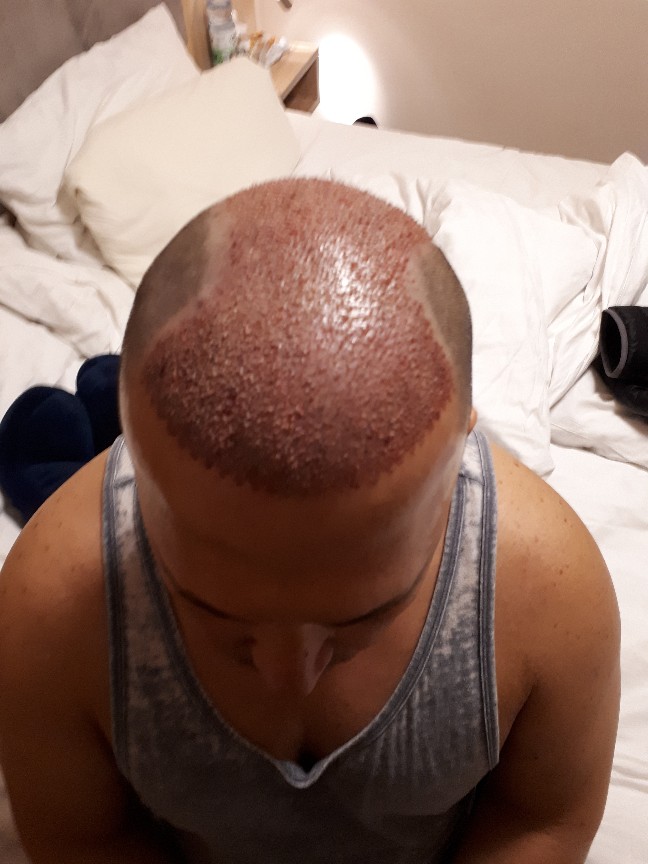 /foren/transplant/index.php?t=getfile&id=41268&private=0