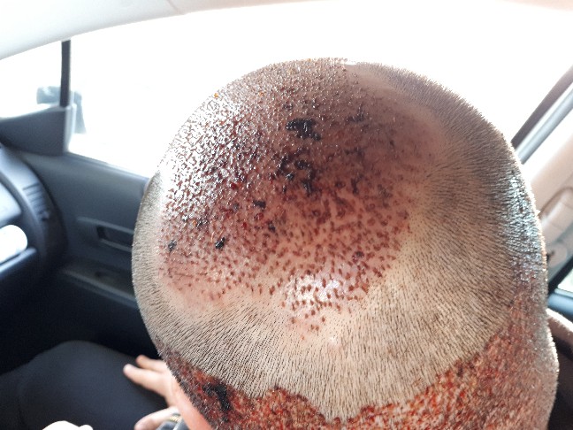 /foren/transplant/index.php?t=getfile&id=41269&private=0