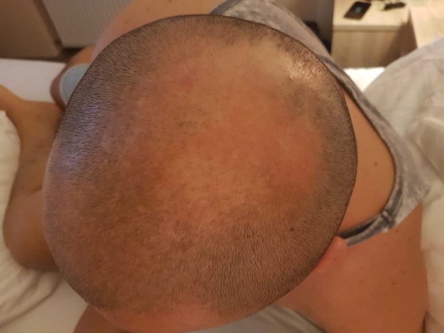 /foren/transplant/index.php?t=getfile&id=41270&private=0