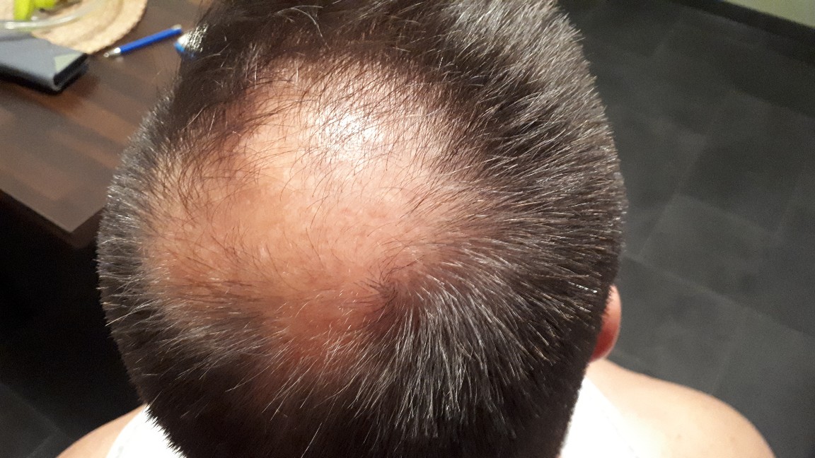 /foren/transplant/index.php?t=getfile&id=41271&private=0