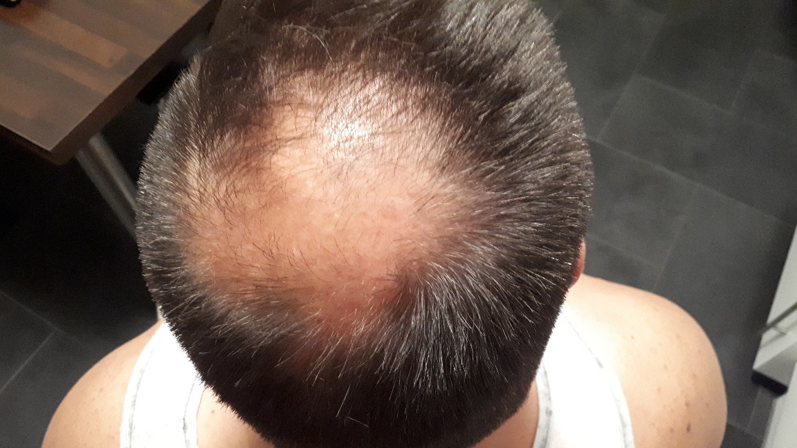 /foren/transplant/index.php?t=getfile&id=41272&private=0