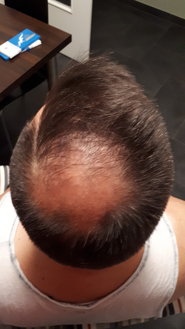 /foren/transplant/index.php?t=getfile&id=41273&private=0