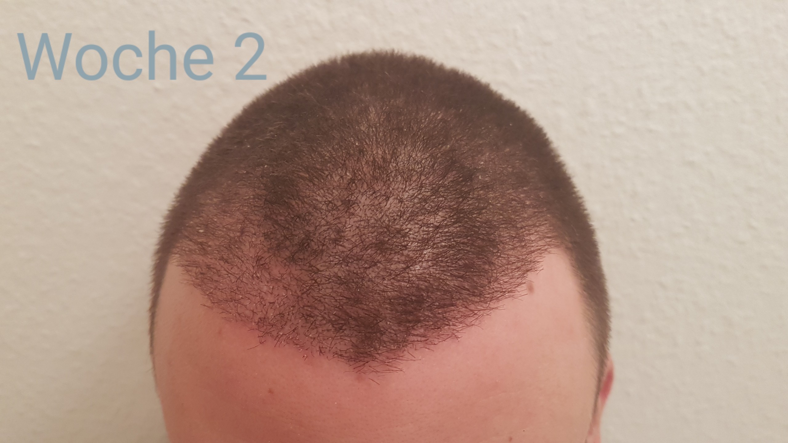 /foren/transplant/index.php?t=getfile&id=41303&private=0