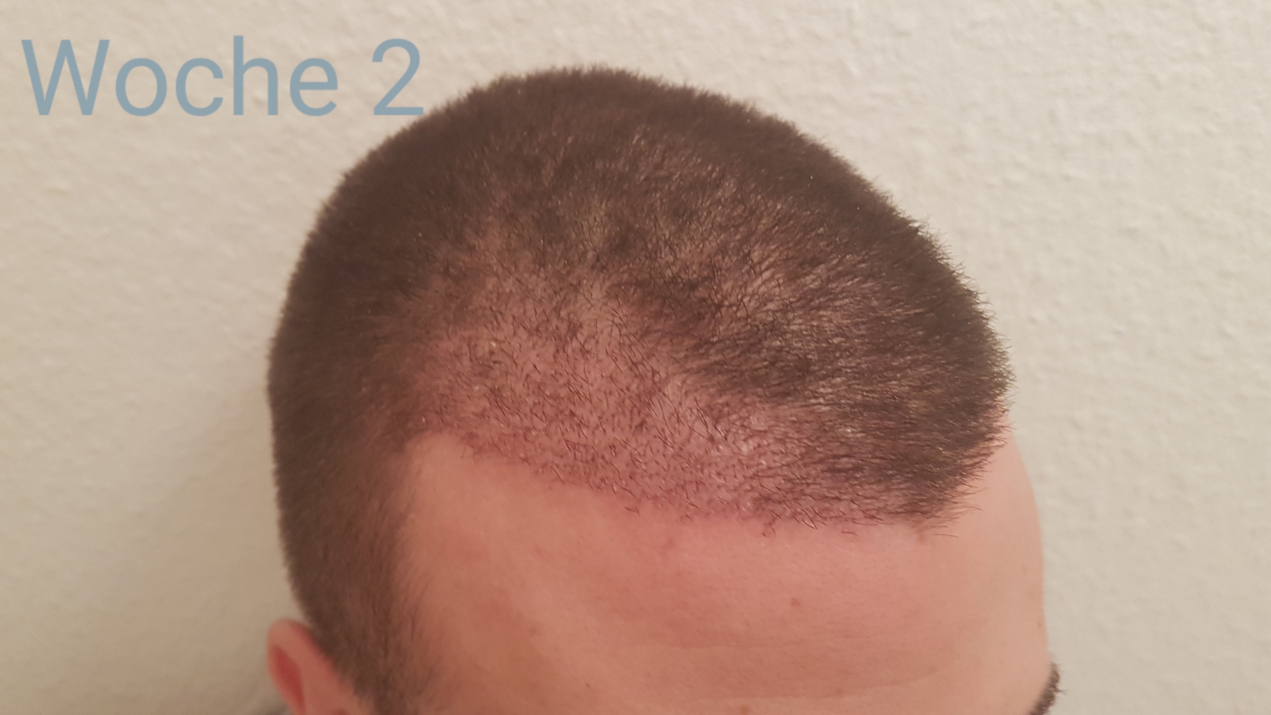 /foren/transplant/index.php?t=getfile&id=41304&private=0