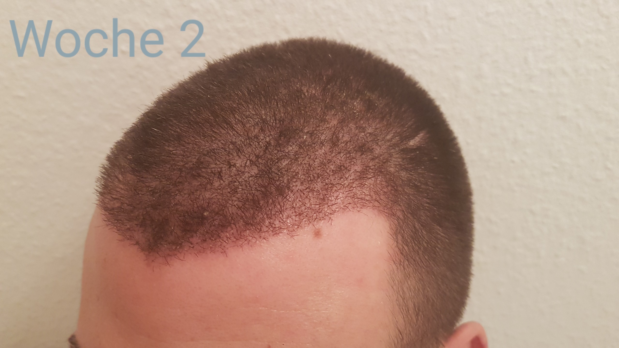 /foren/transplant/index.php?t=getfile&id=41305&private=0