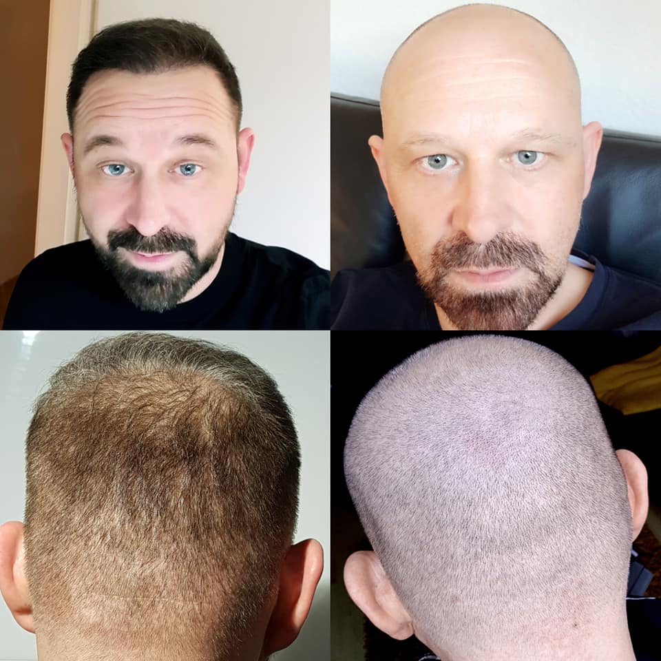 /foren/transplant/index.php?t=getfile&id=41308&private=0