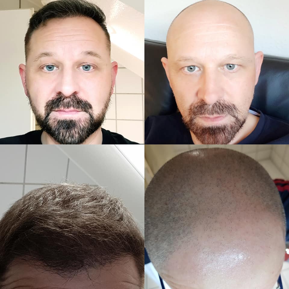 /foren/transplant/index.php?t=getfile&id=41309&private=0