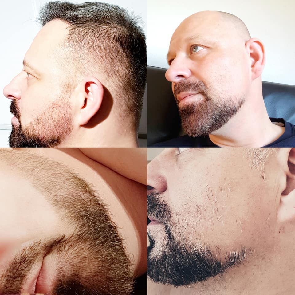 /foren/transplant/index.php?t=getfile&id=41310&private=0