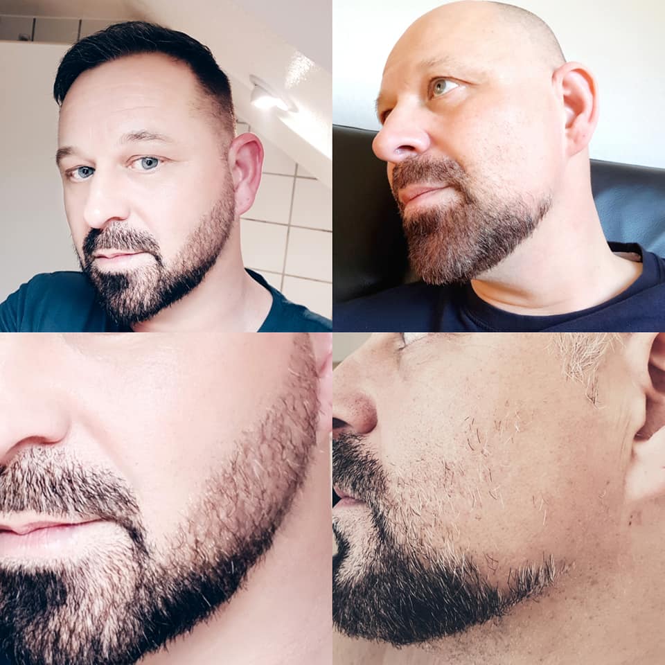 /foren/transplant/index.php?t=getfile&id=41311&private=0