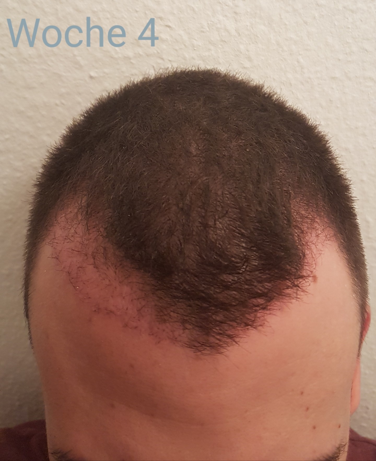 /foren/transplant/index.php?t=getfile&id=41496&private=0