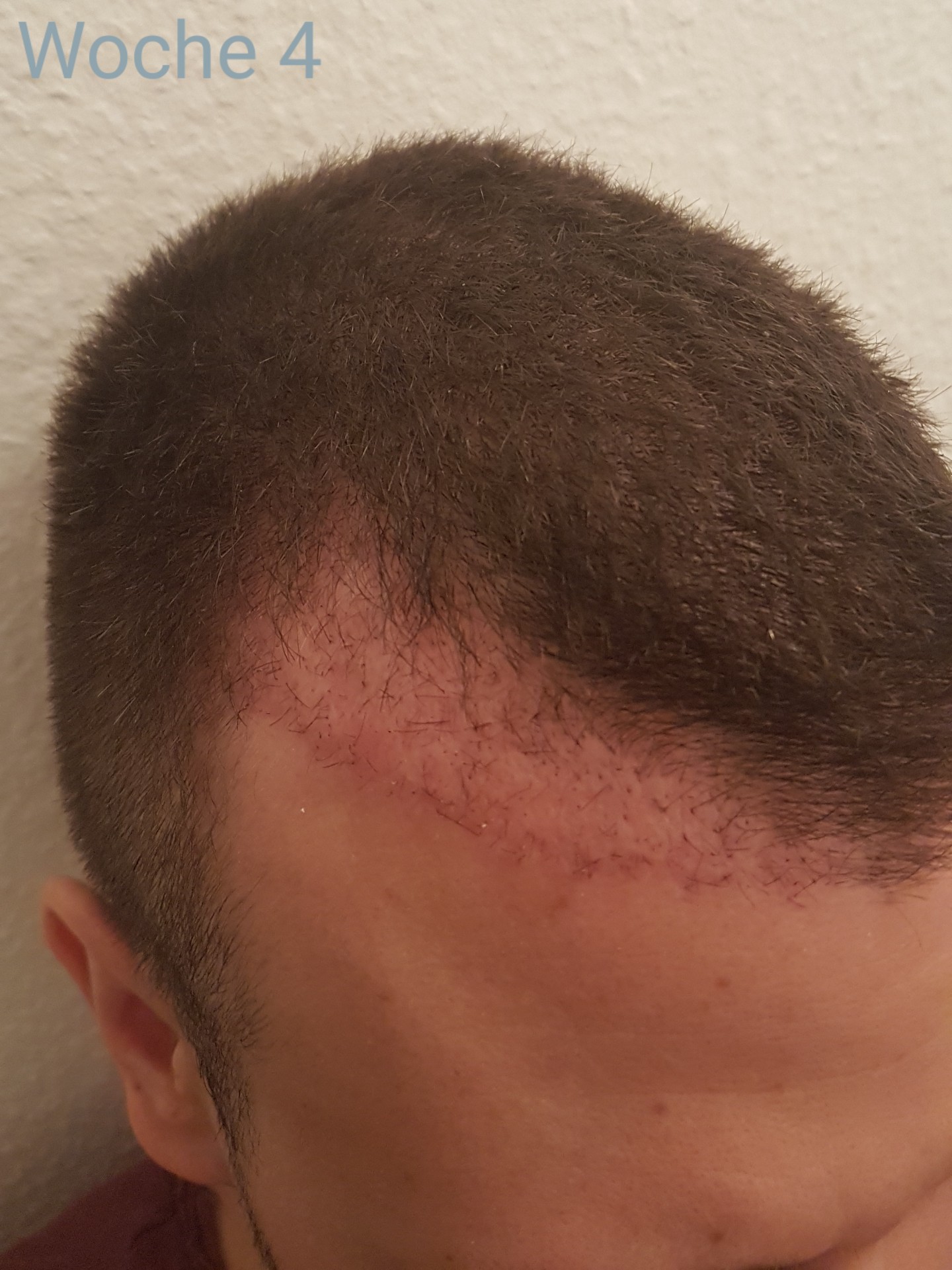 /foren/transplant/index.php?t=getfile&id=41498&private=0