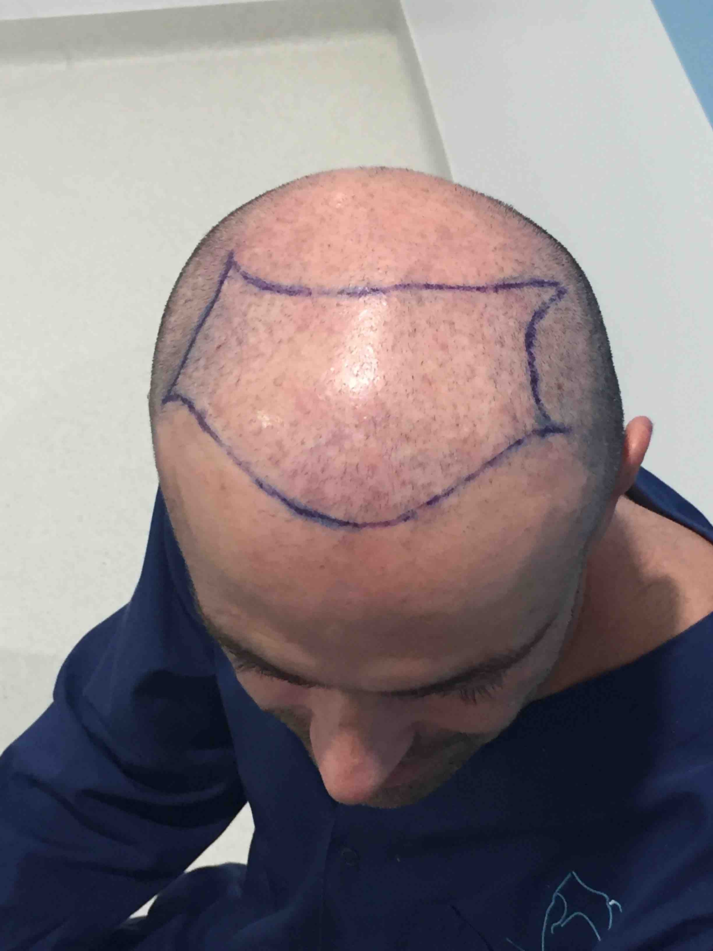 /foren/transplant/index.php?t=getfile&id=41541&private=0