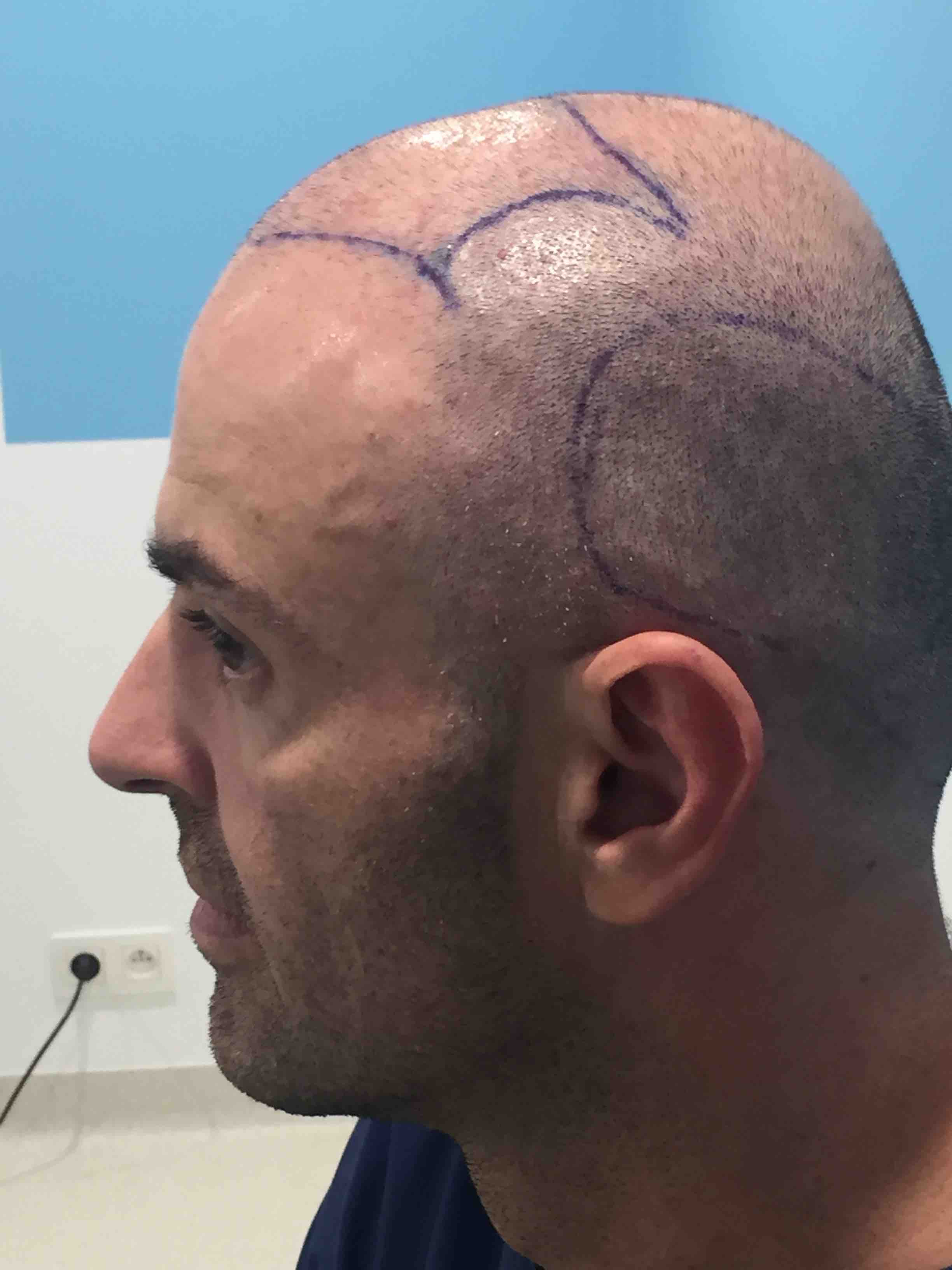 /foren/transplant/index.php?t=getfile&id=41542&private=0