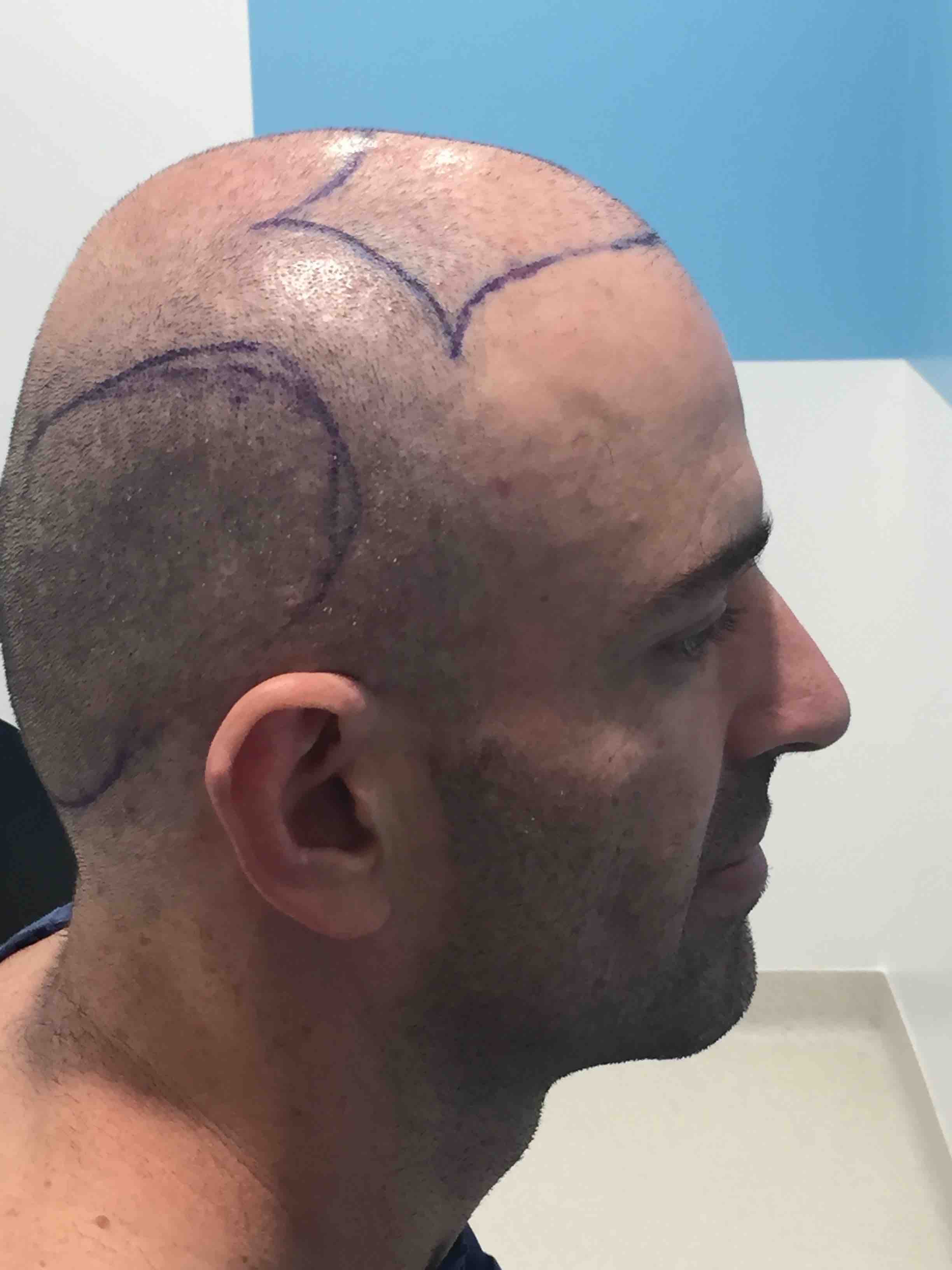 /foren/transplant/index.php?t=getfile&id=41543&private=0