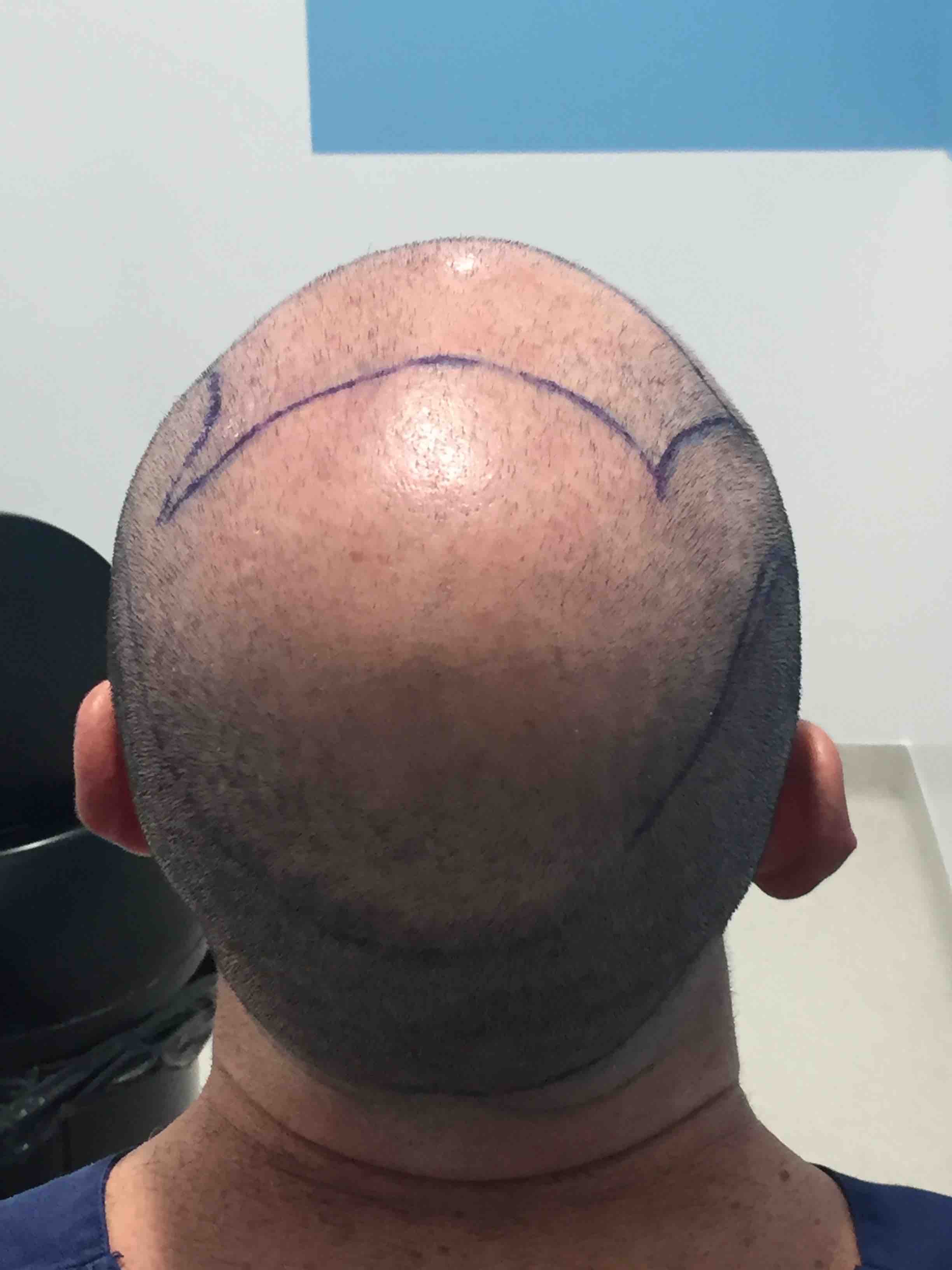 /foren/transplant/index.php?t=getfile&id=41544&private=0