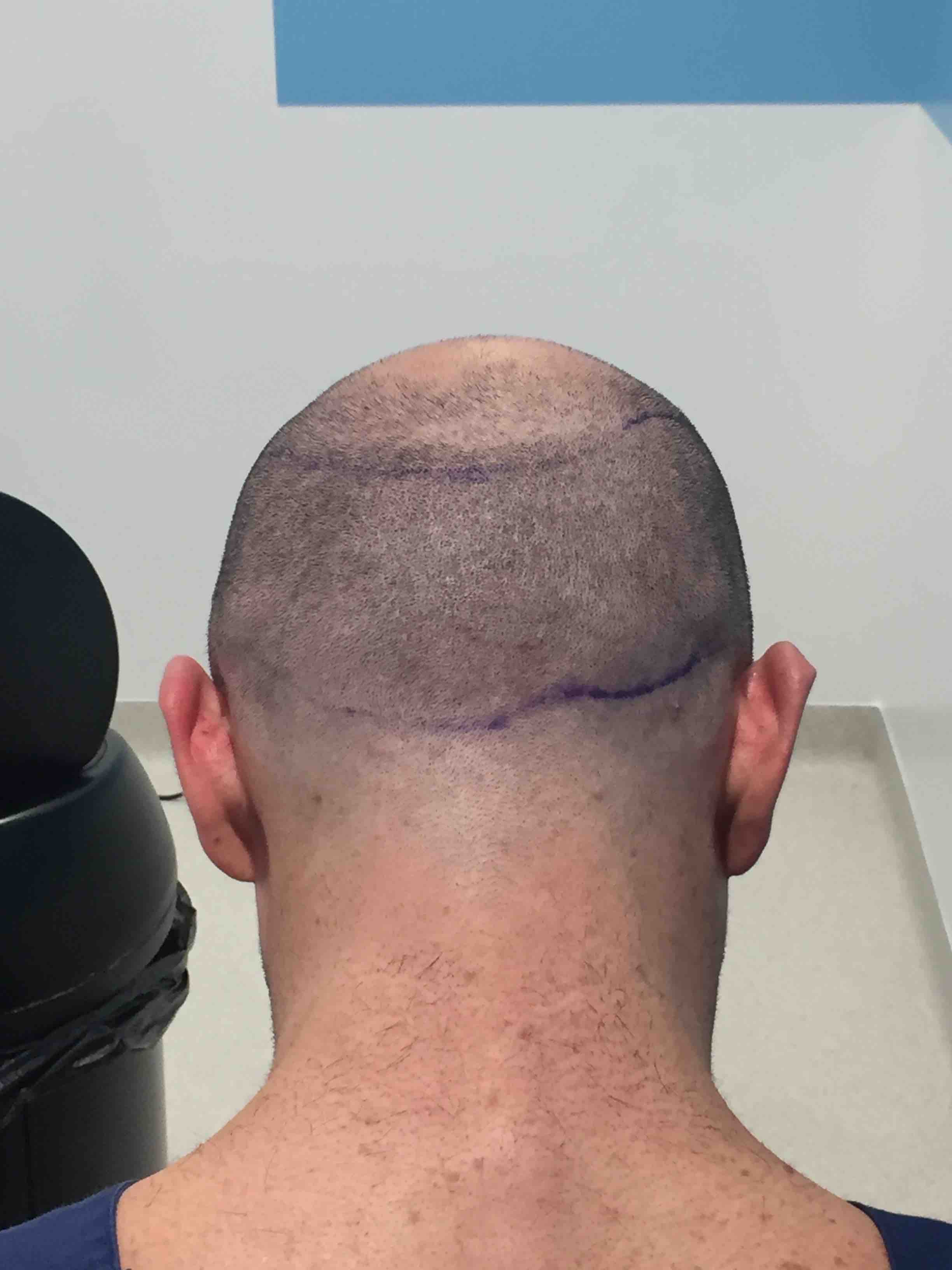 /foren/transplant/index.php?t=getfile&id=41545&private=0