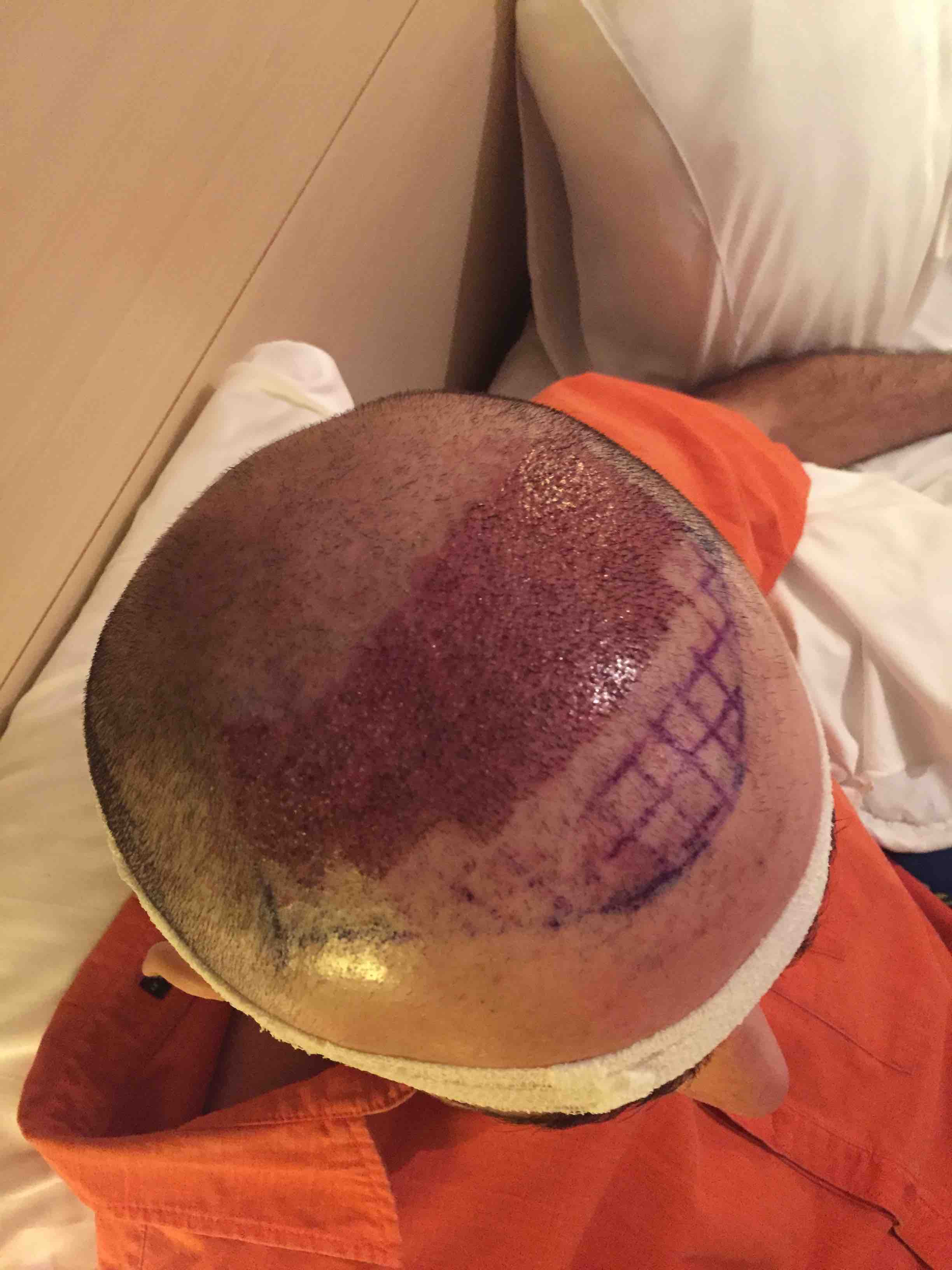 /foren/transplant/index.php?t=getfile&id=41546&private=0