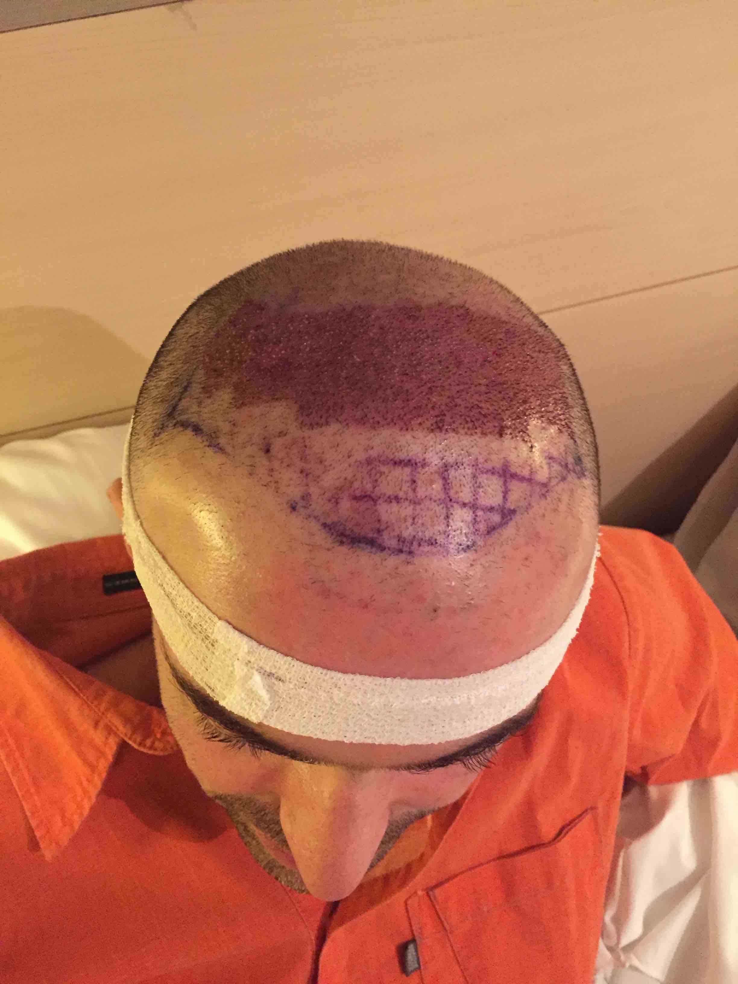 /foren/transplant/index.php?t=getfile&id=41547&private=0