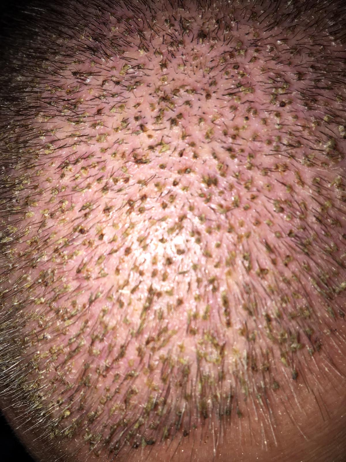 /foren/transplant/index.php?t=getfile&id=41577&private=0