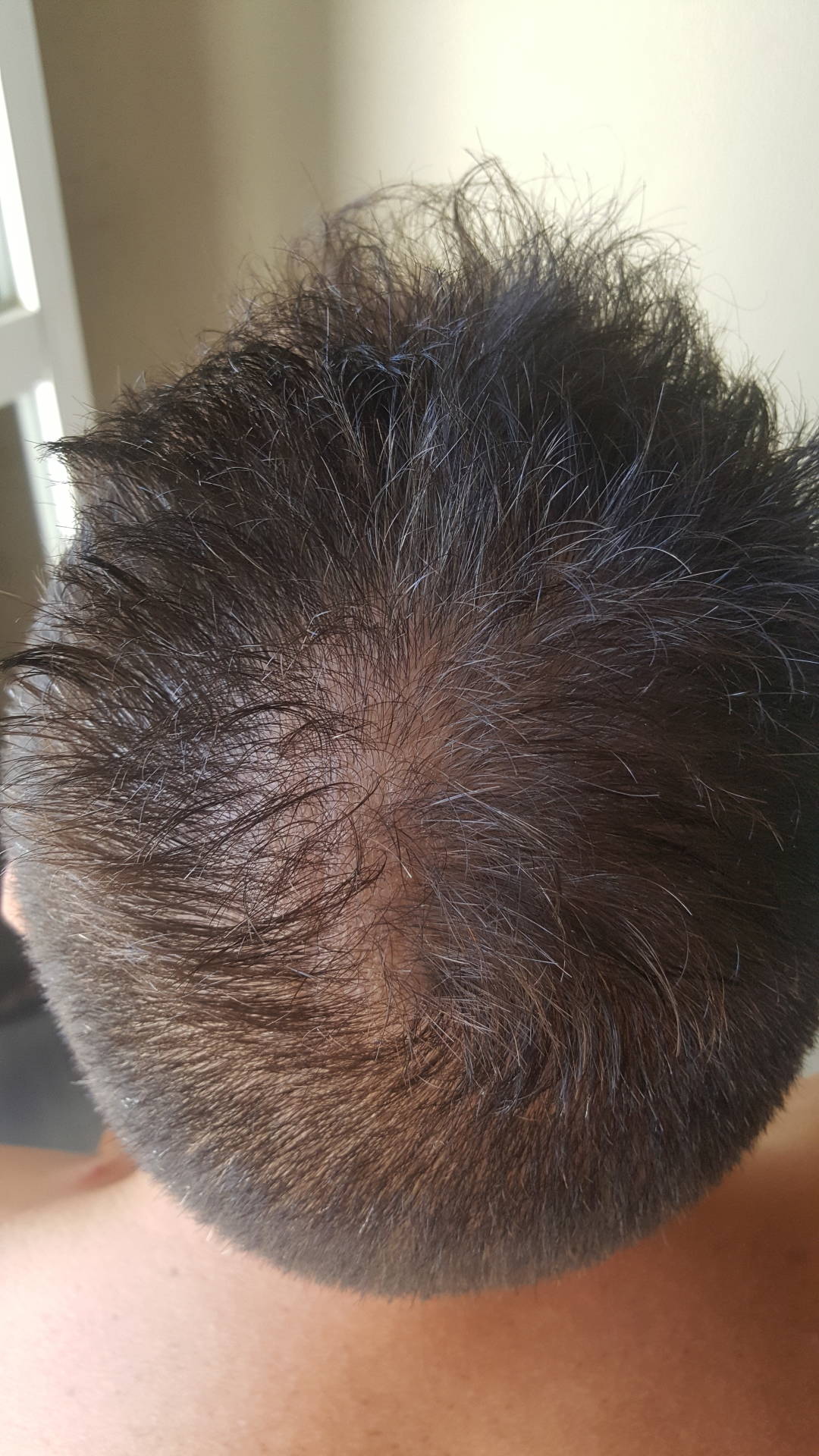 /foren/transplant/index.php?t=getfile&id=41598&private=0