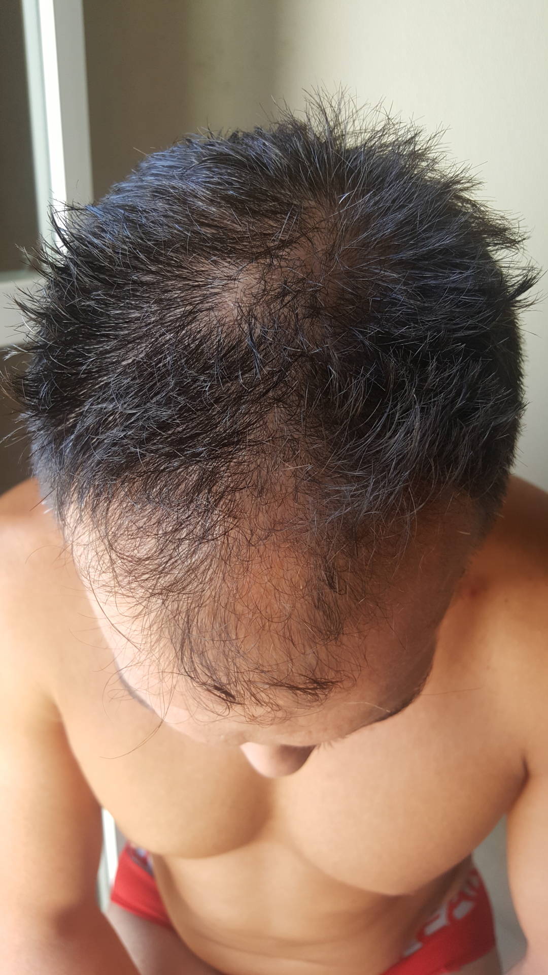 /foren/transplant/index.php?t=getfile&id=41599&private=0