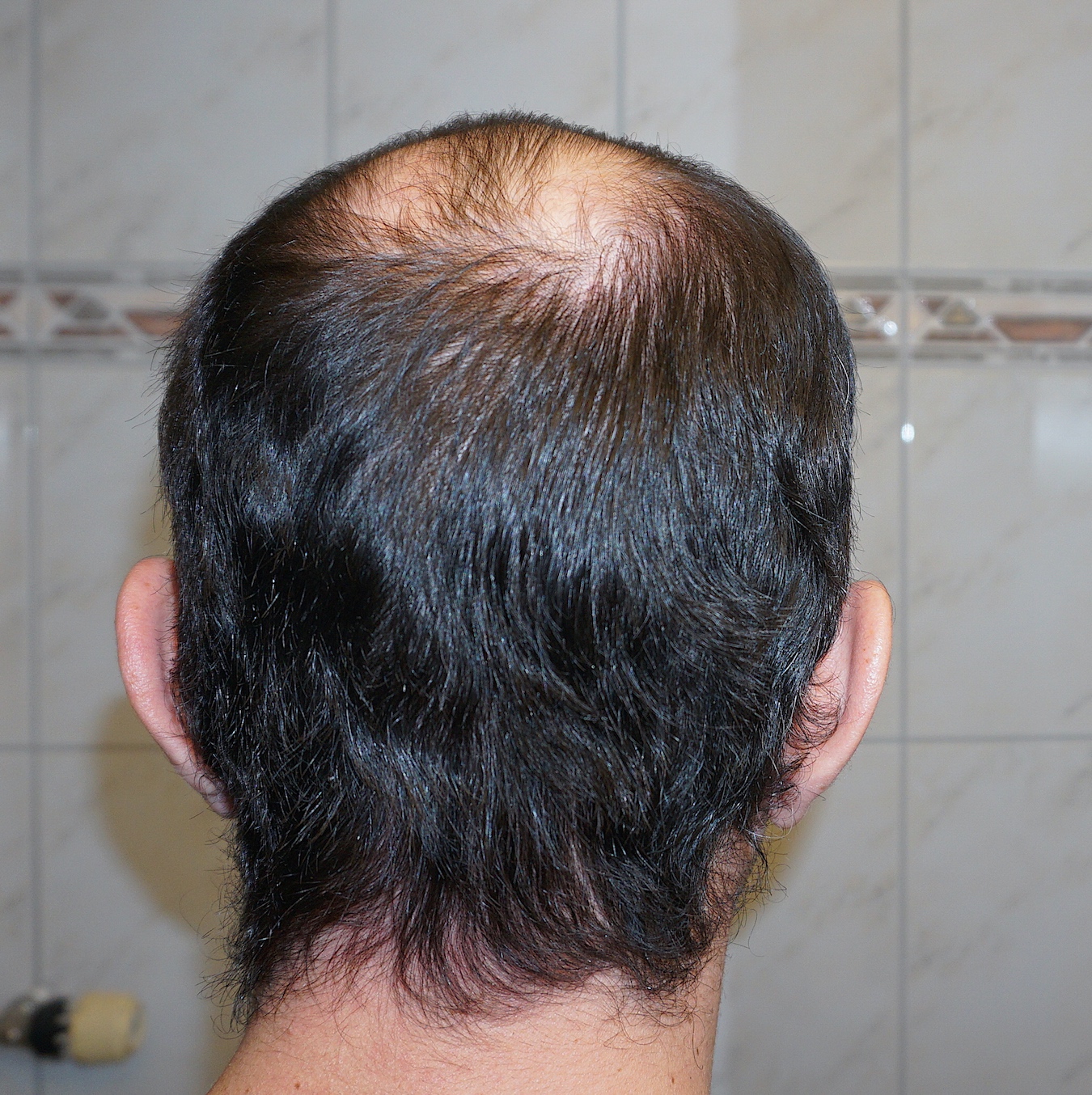 /foren/transplant/index.php?t=getfile&id=41611&private=0