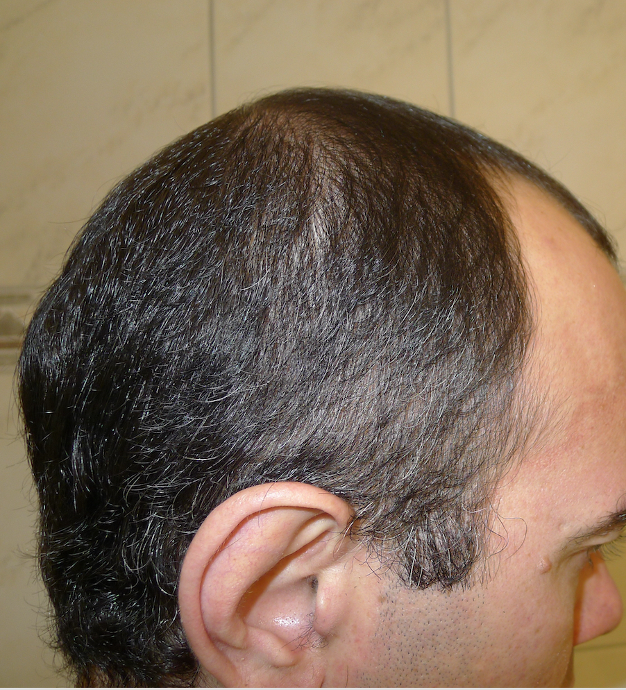 /foren/transplant/index.php?t=getfile&id=41614&private=0