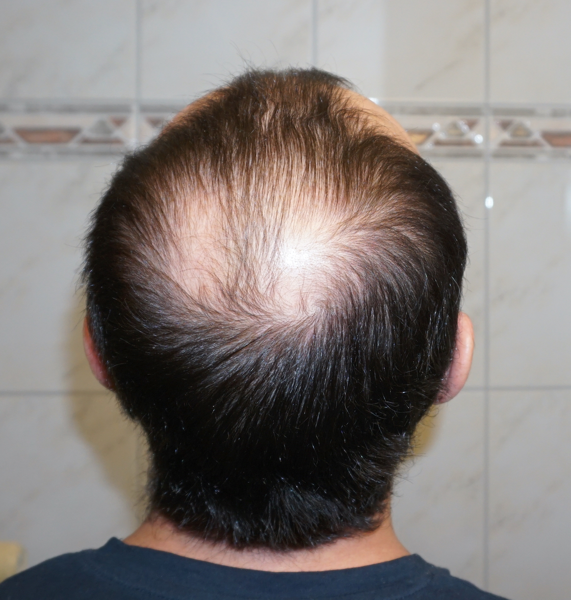 /foren/transplant/index.php?t=getfile&id=41615&private=0