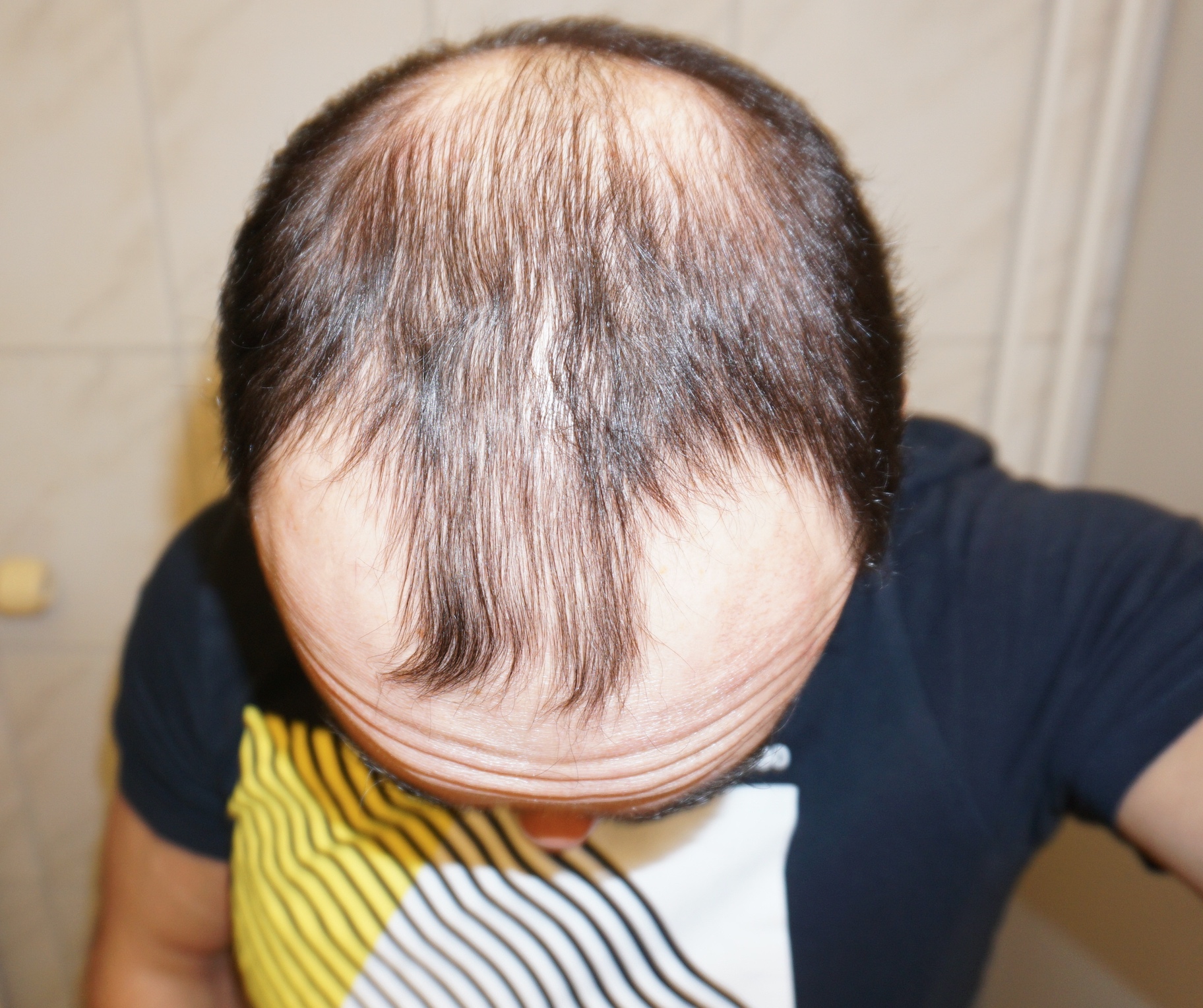 /foren/transplant/index.php?t=getfile&id=41616&private=0