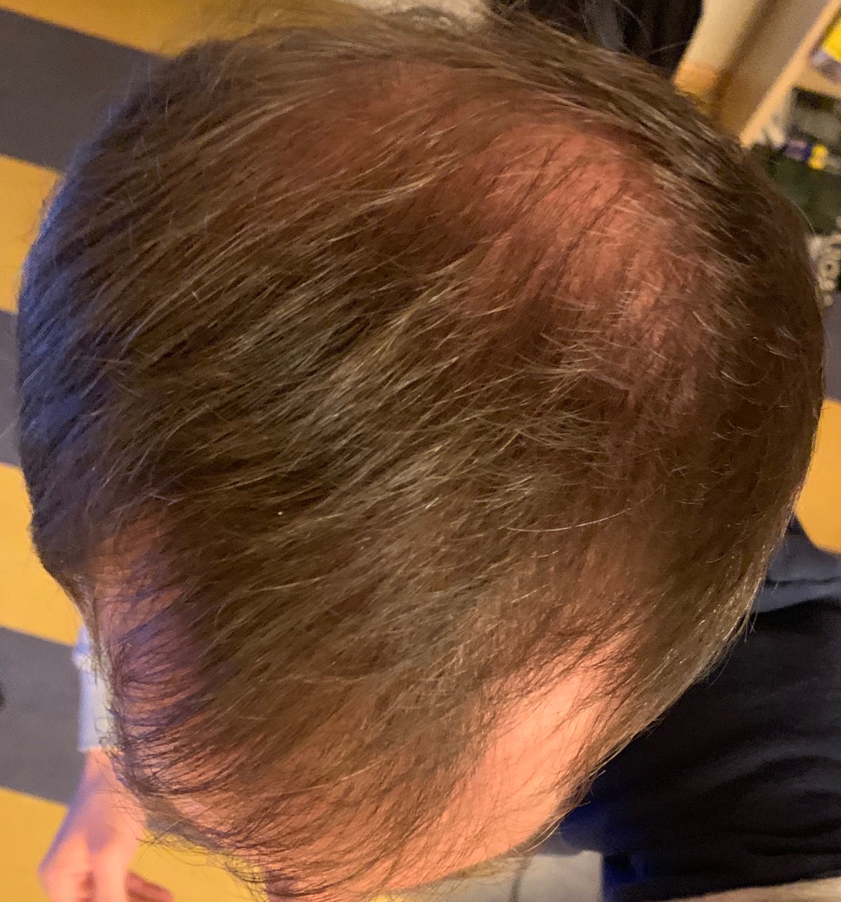 /foren/transplant/index.php?t=getfile&id=41663&private=0