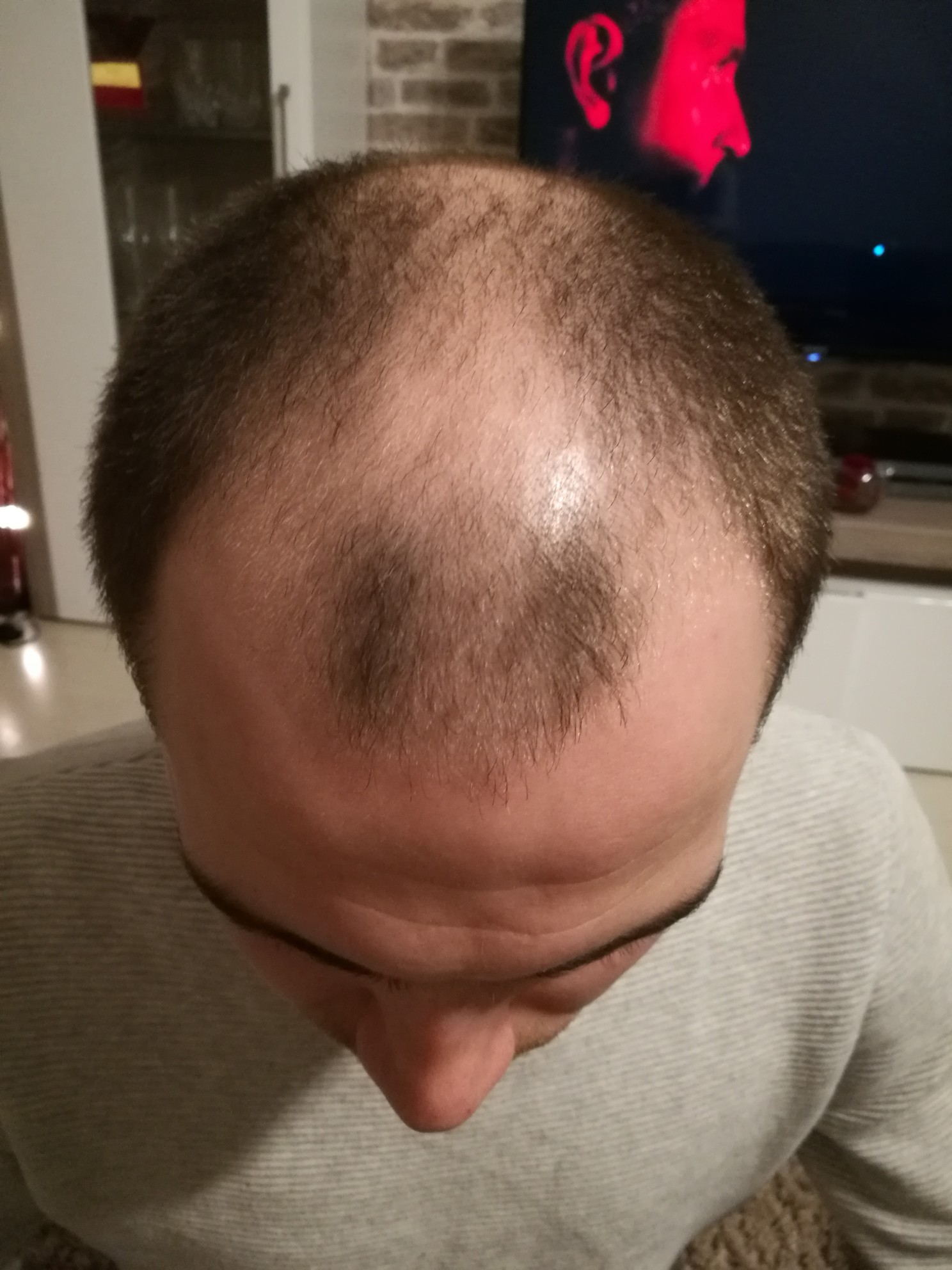 /foren/transplant/index.php?t=getfile&id=41665&private=0