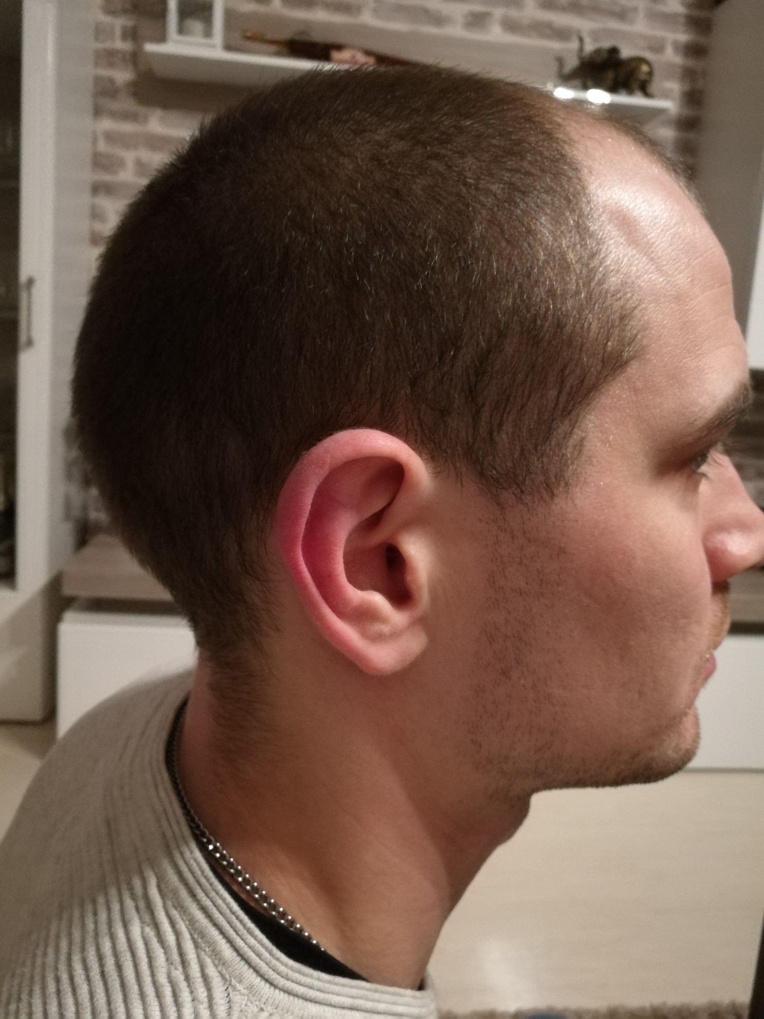 /foren/transplant/index.php?t=getfile&id=41667&private=0