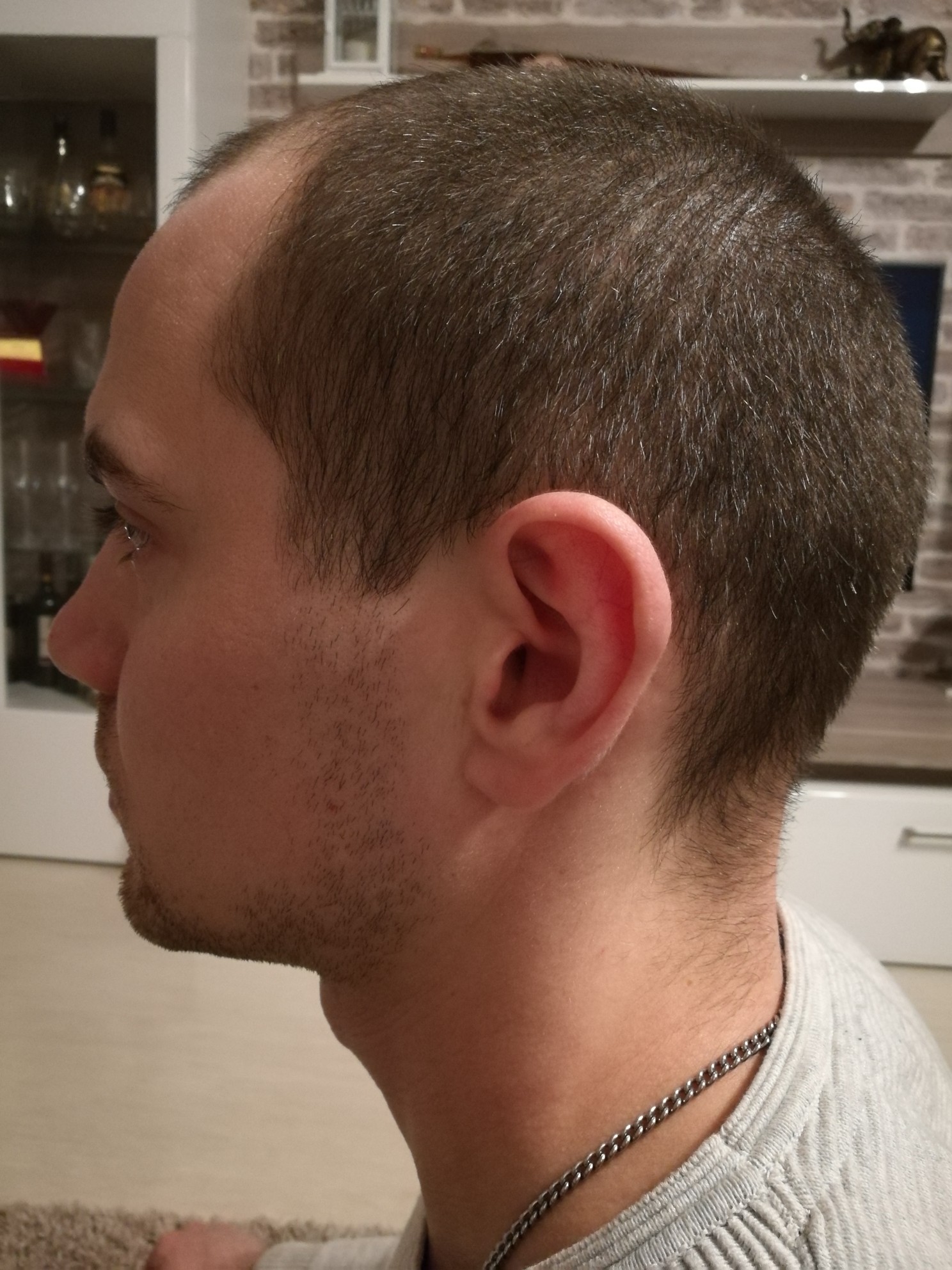 /foren/transplant/index.php?t=getfile&id=41668&private=0