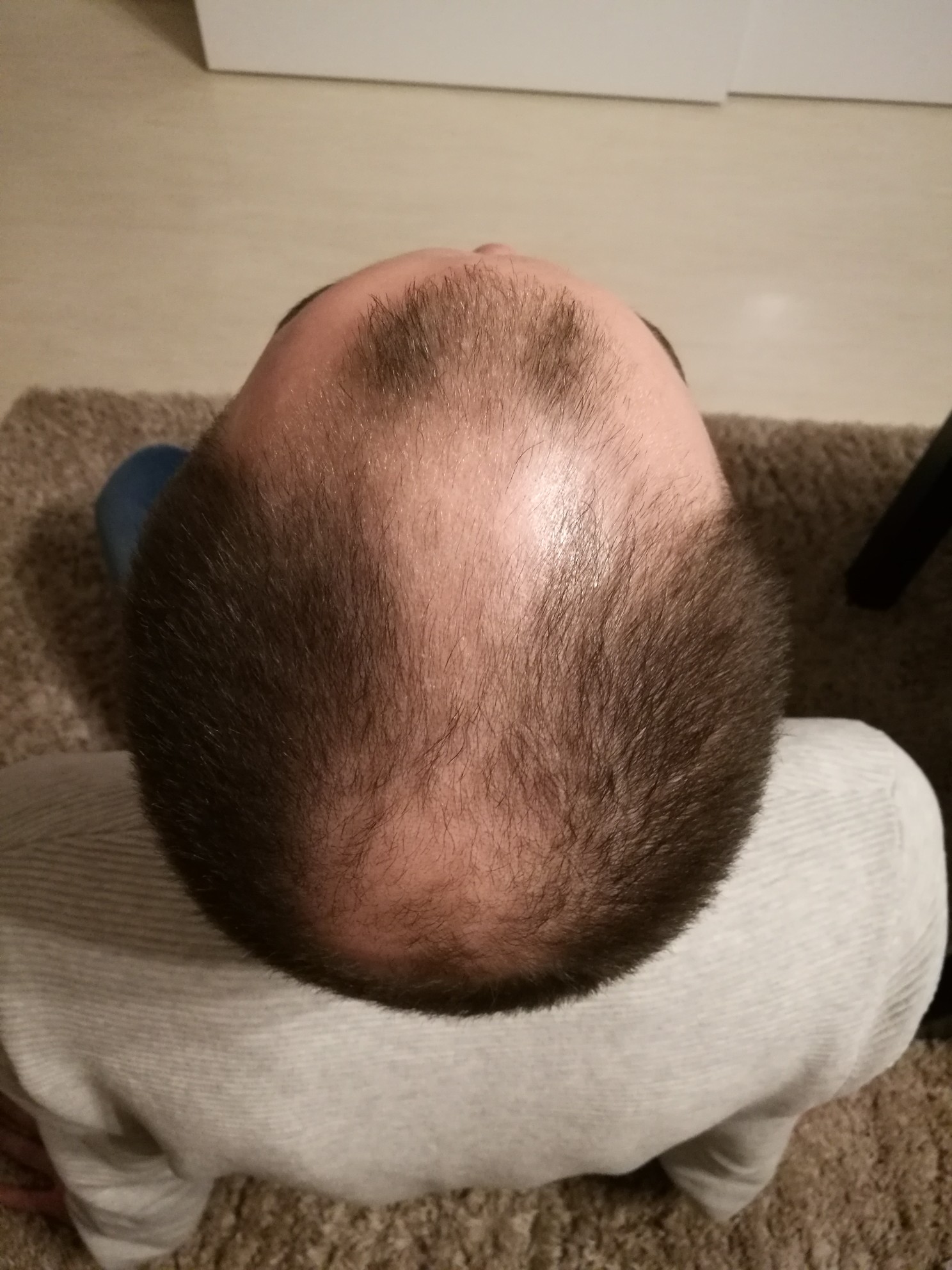 /foren/transplant/index.php?t=getfile&id=41669&private=0