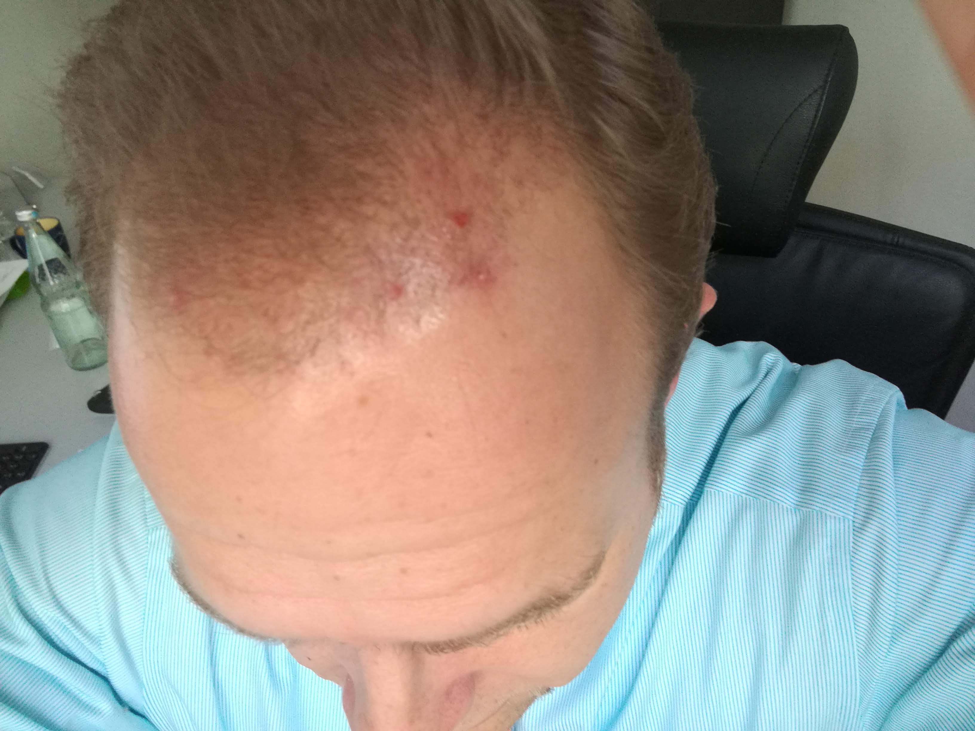 /foren/transplant/index.php?t=getfile&id=41776&private=0