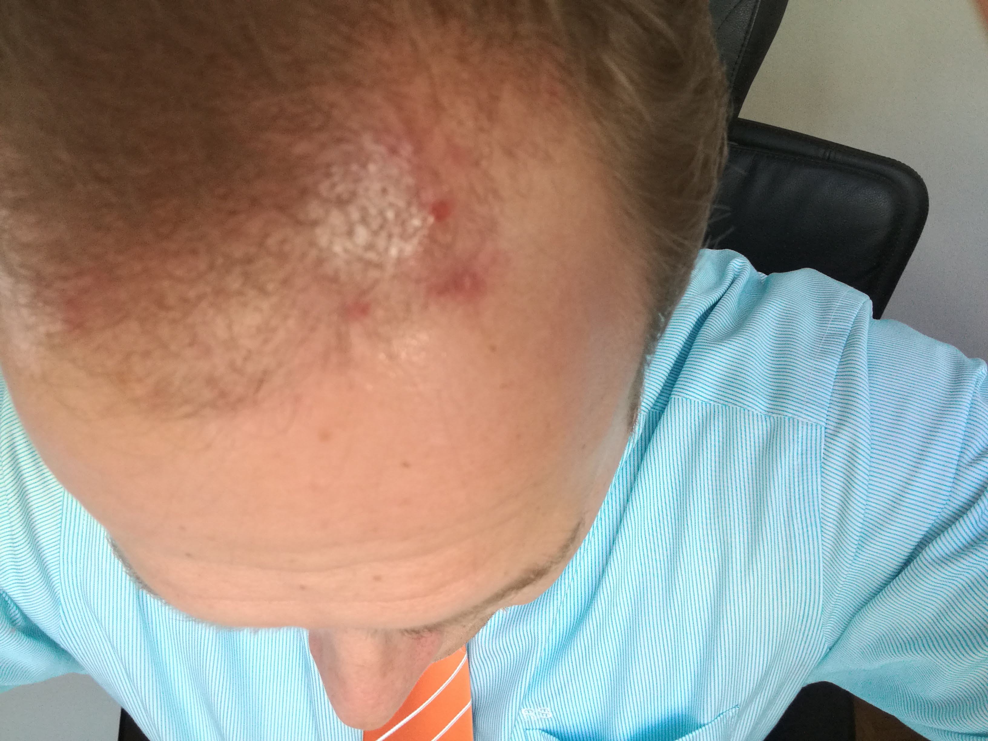 /foren/transplant/index.php?t=getfile&id=41777&private=0