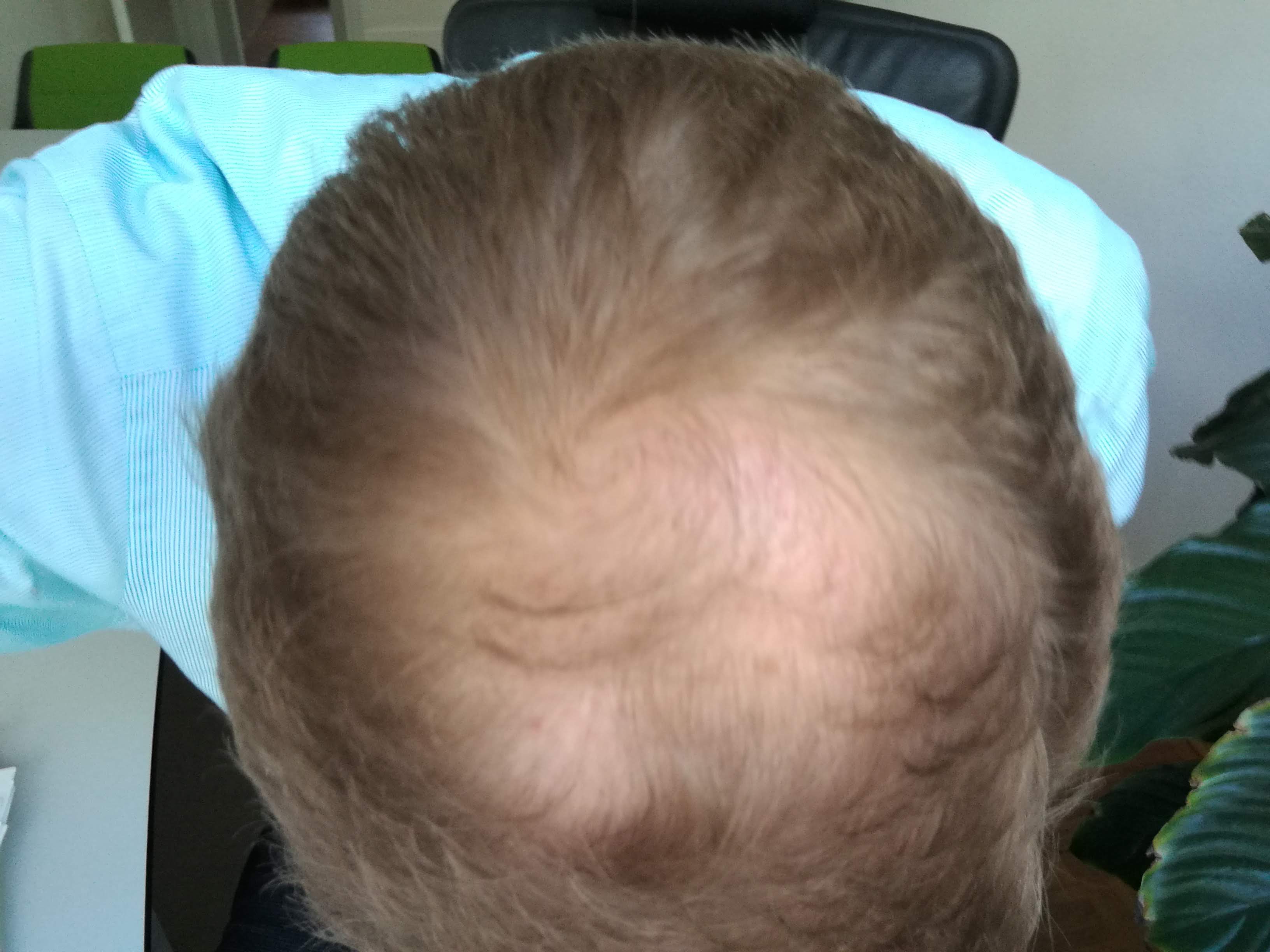 /foren/transplant/index.php?t=getfile&id=41780&private=0