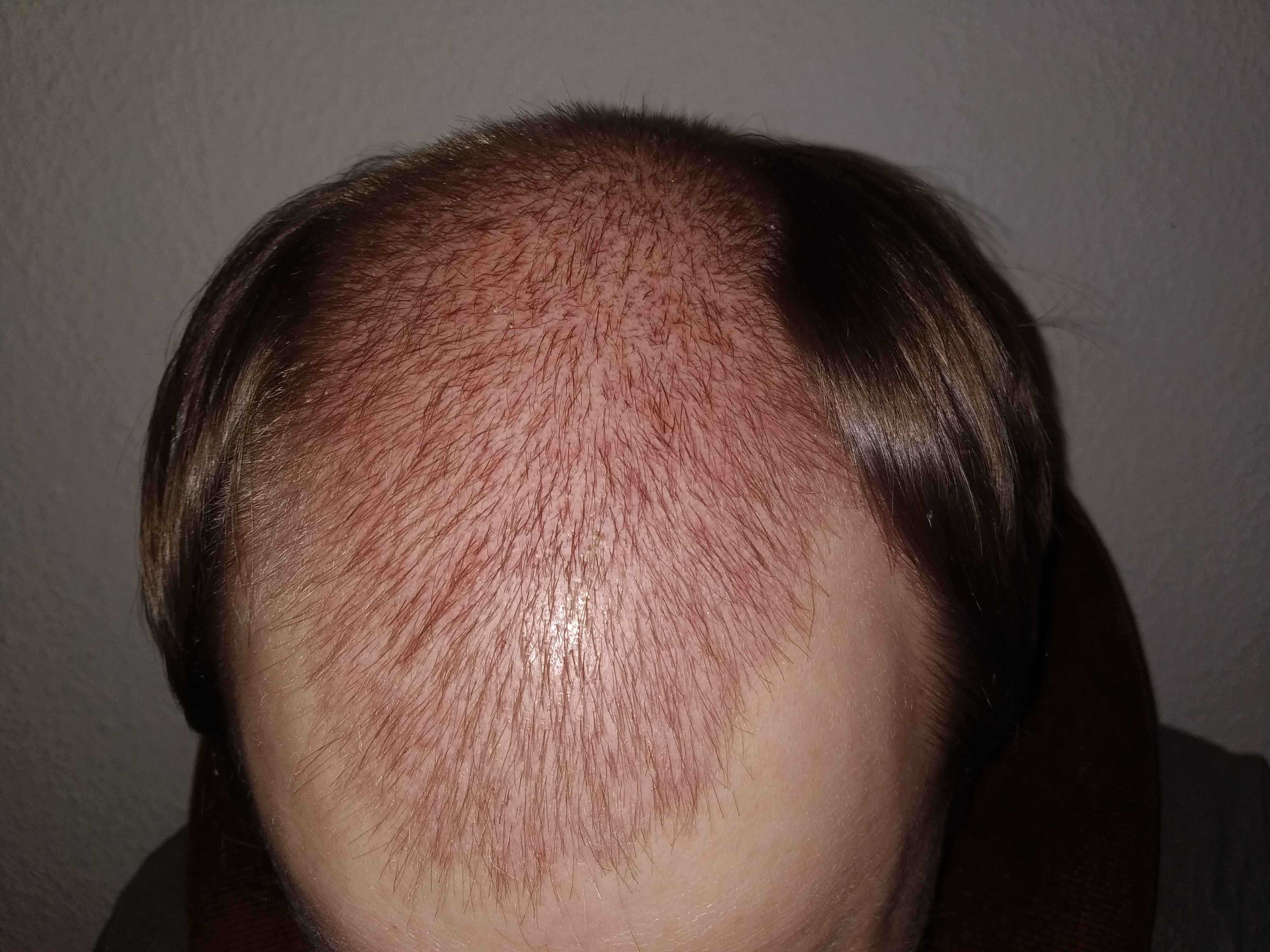 /foren/transplant/index.php?t=getfile&id=41862&private=0