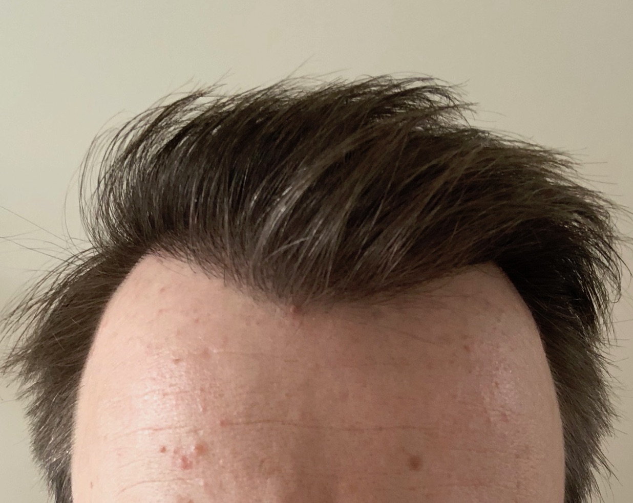 /foren/transplant/index.php?t=getfile&id=41898&private=0