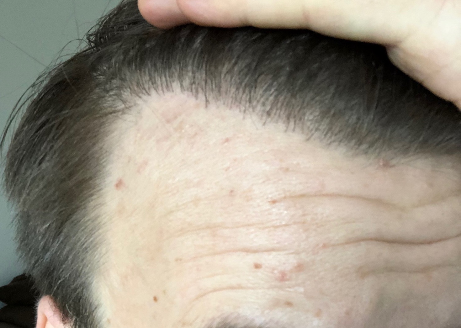 /foren/transplant/index.php?t=getfile&id=41900&private=0