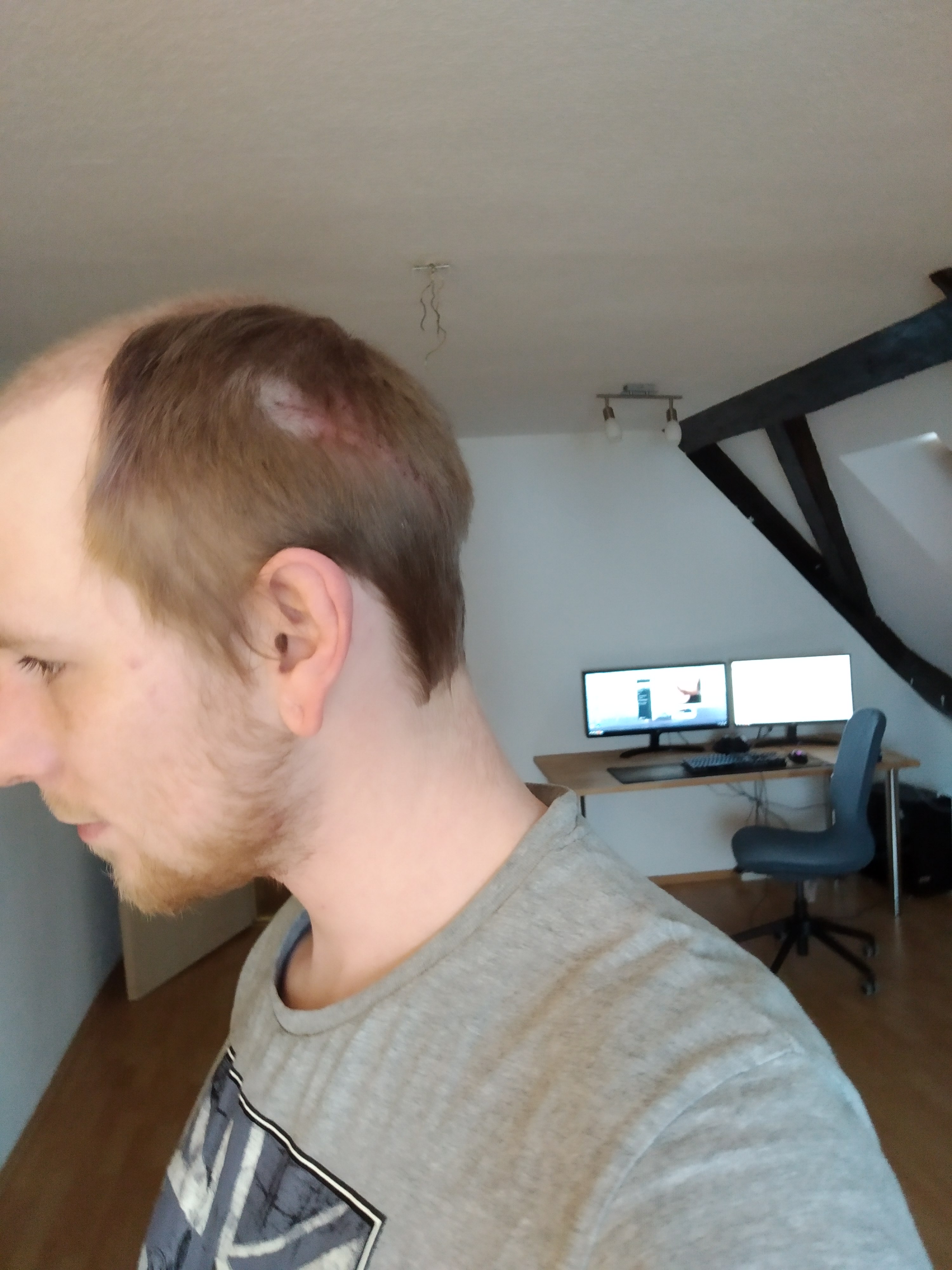 /foren/transplant/index.php?t=getfile&id=41906&private=0