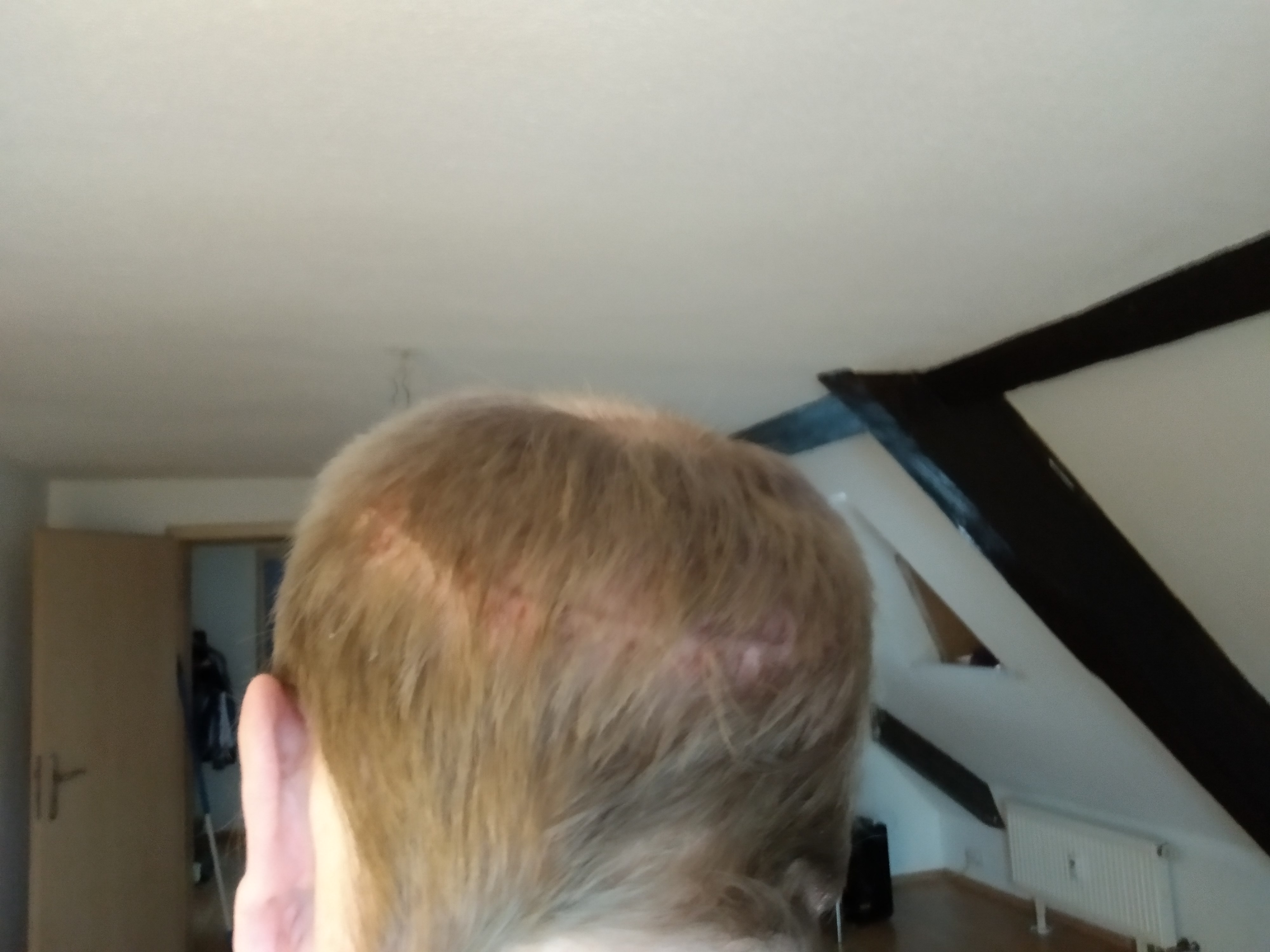 /foren/transplant/index.php?t=getfile&id=41907&private=0