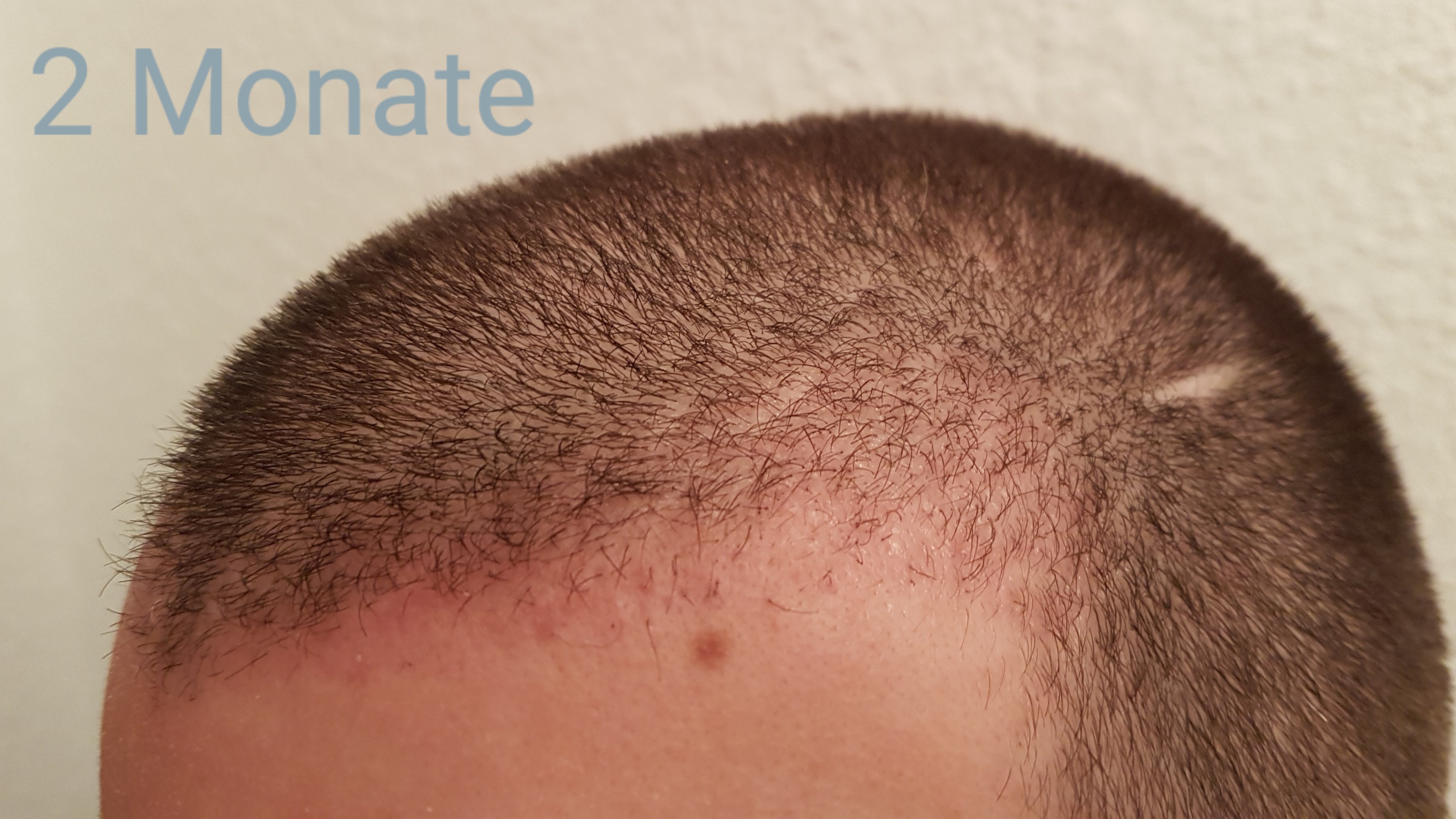 /foren/transplant/index.php?t=getfile&id=41915&private=0