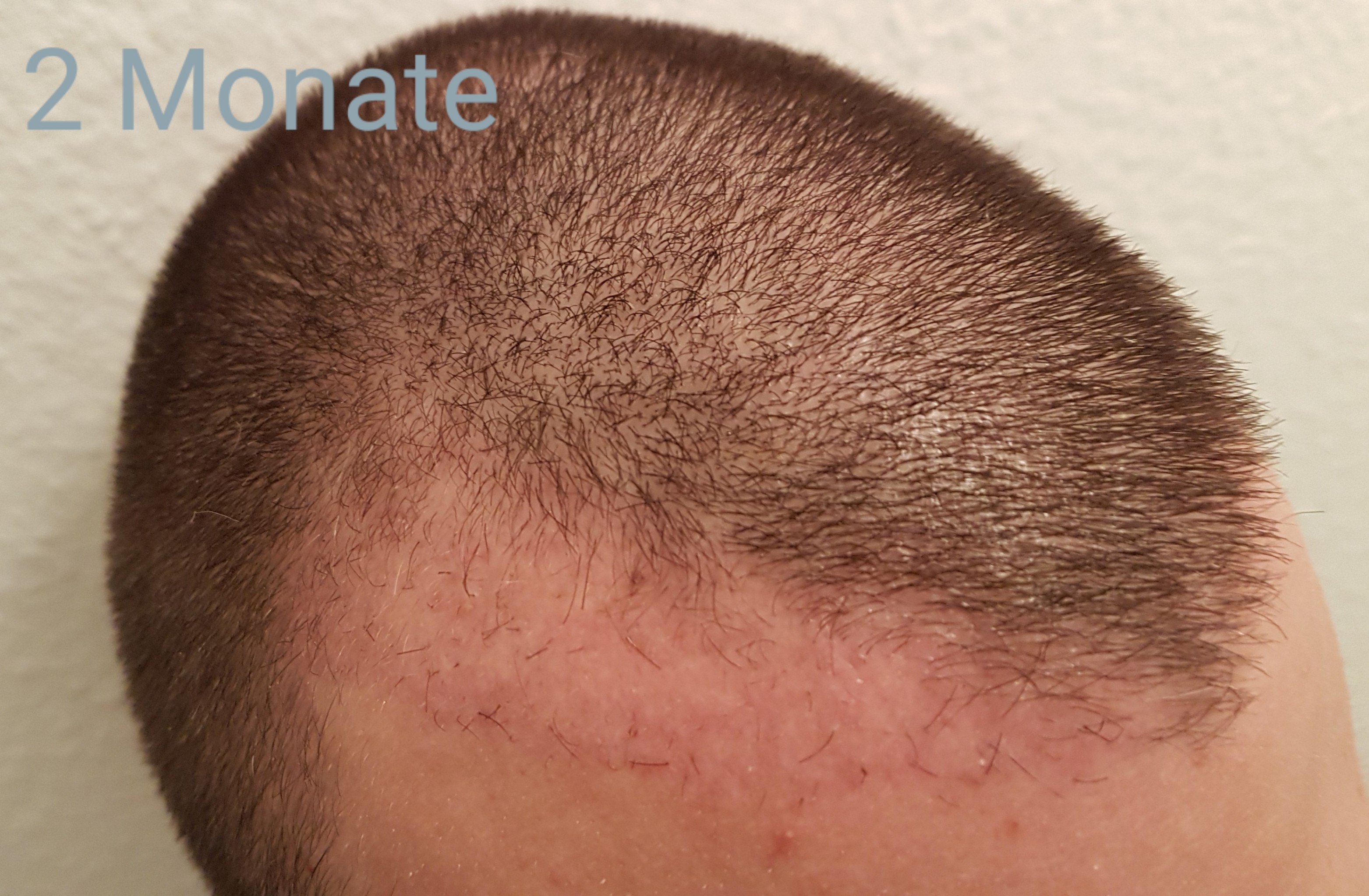 /foren/transplant/index.php?t=getfile&id=41916&private=0