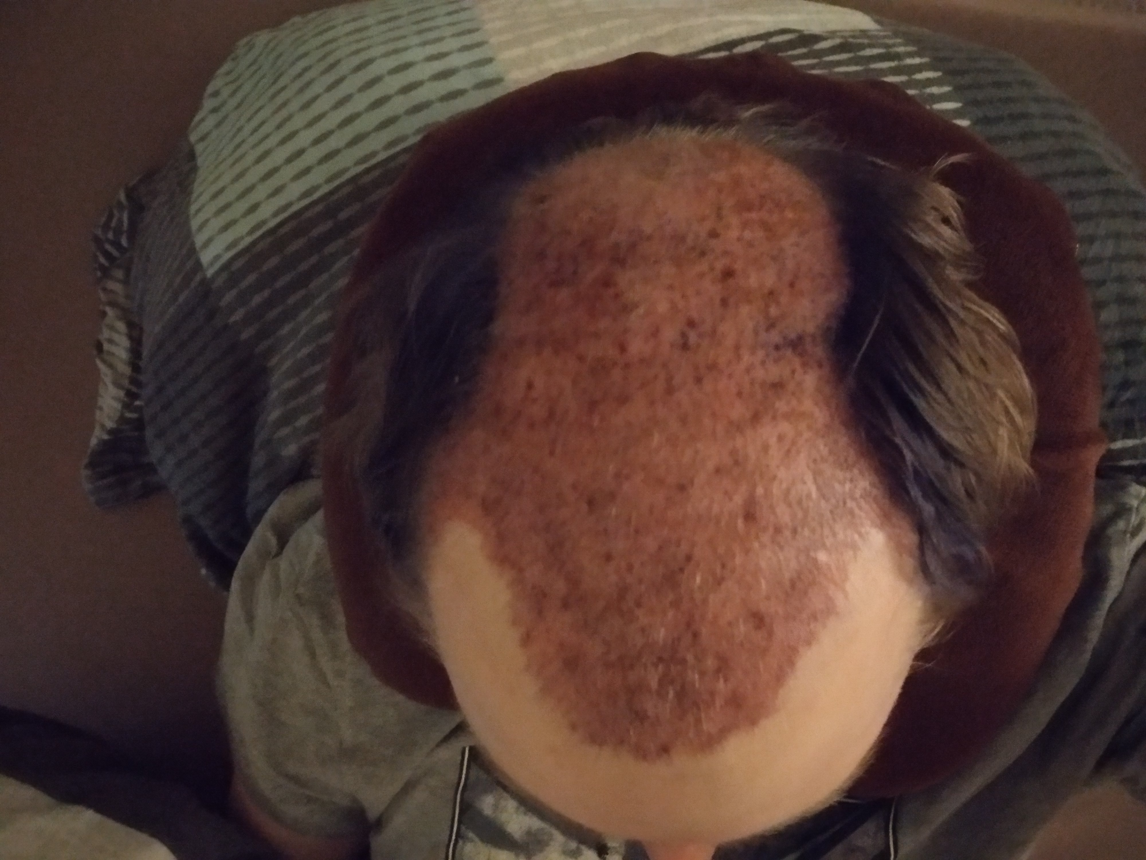 /foren/transplant/index.php?t=getfile&id=41988&private=0