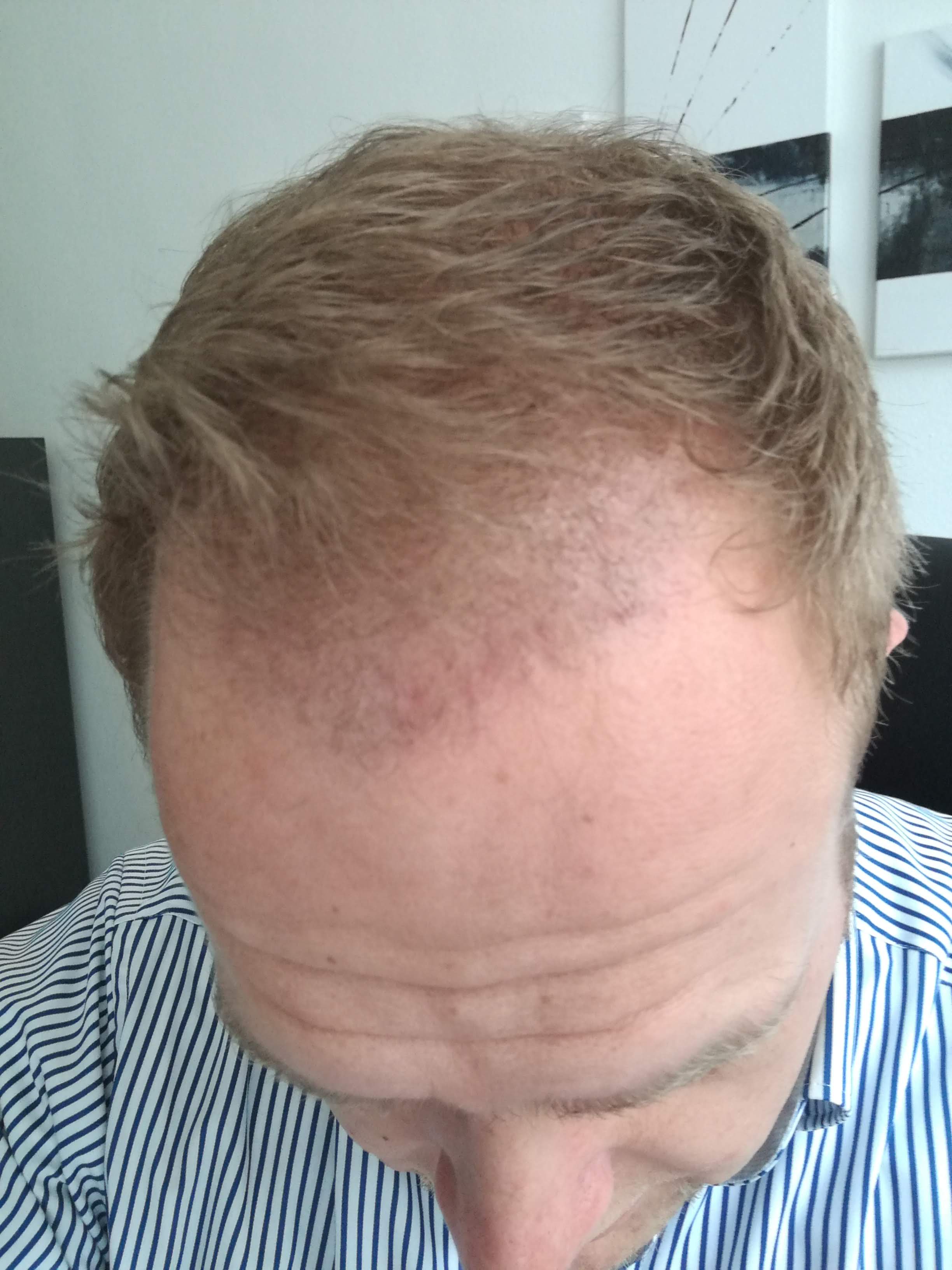 /foren/transplant/index.php?t=getfile&id=42046&private=0