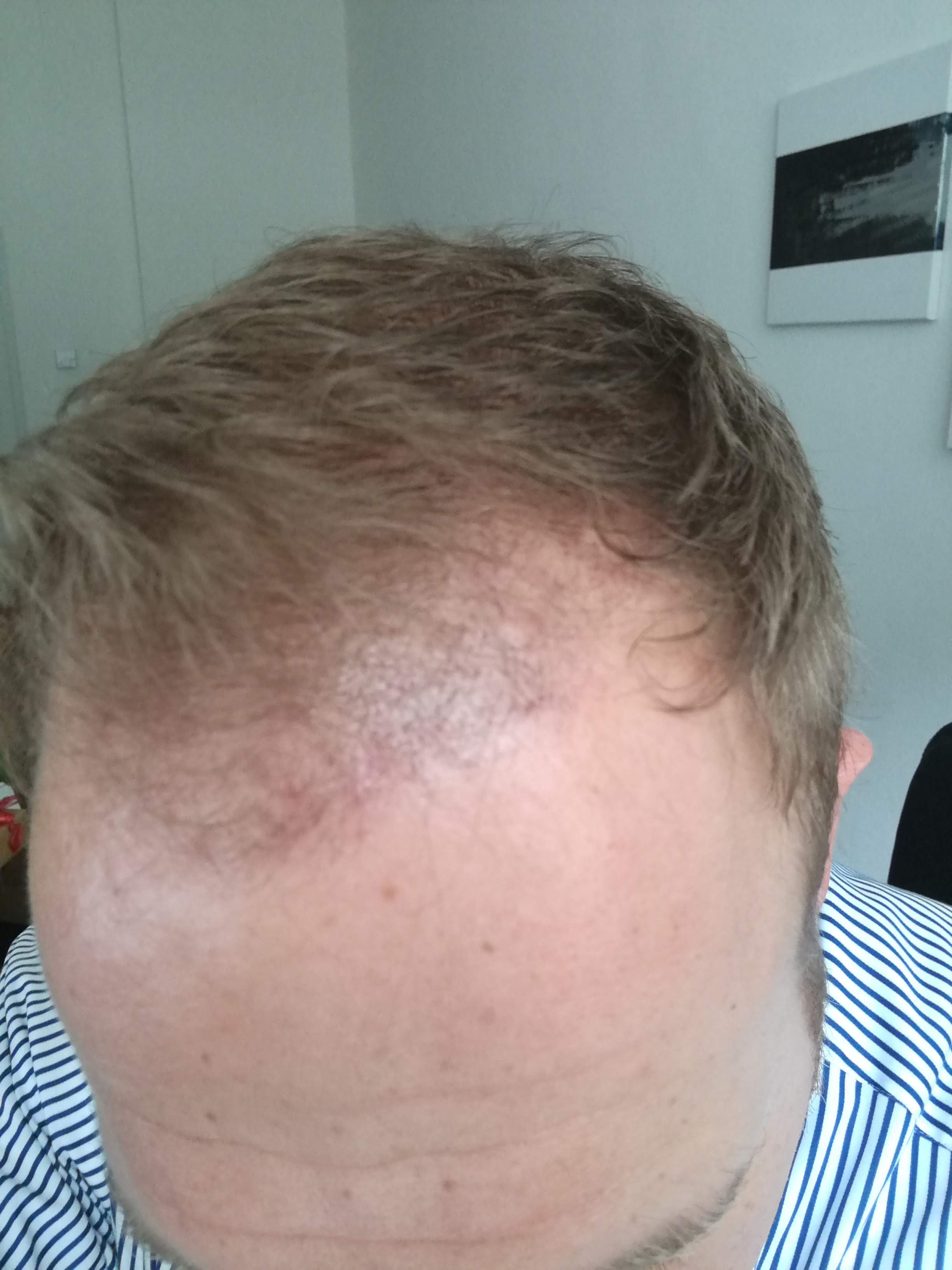 /foren/transplant/index.php?t=getfile&id=42048&private=0