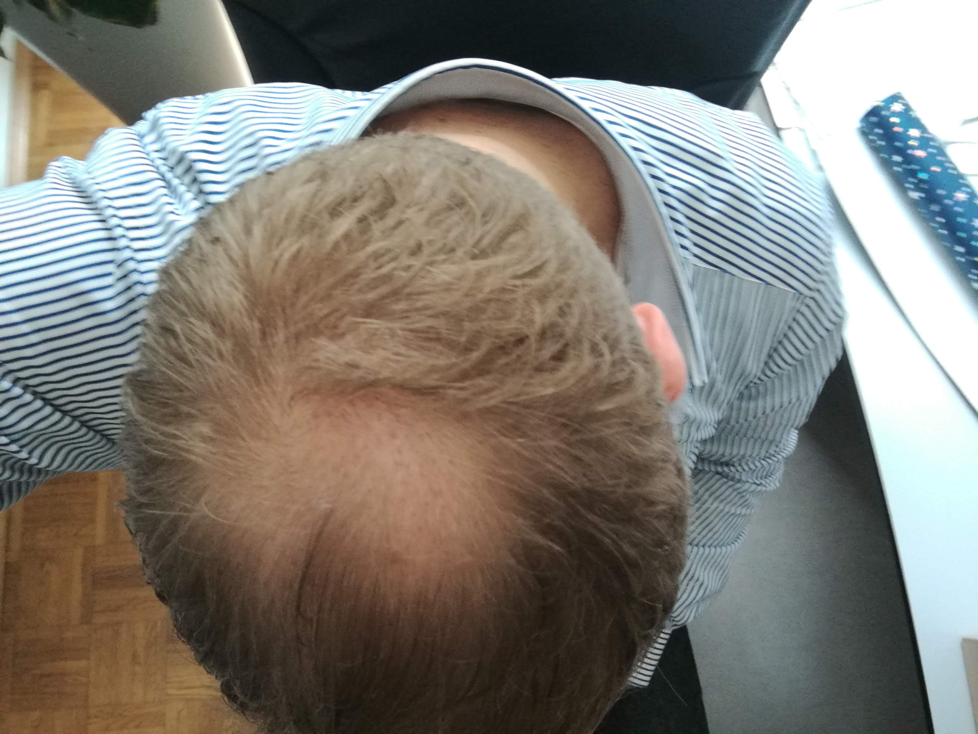 /foren/transplant/index.php?t=getfile&id=42049&private=0