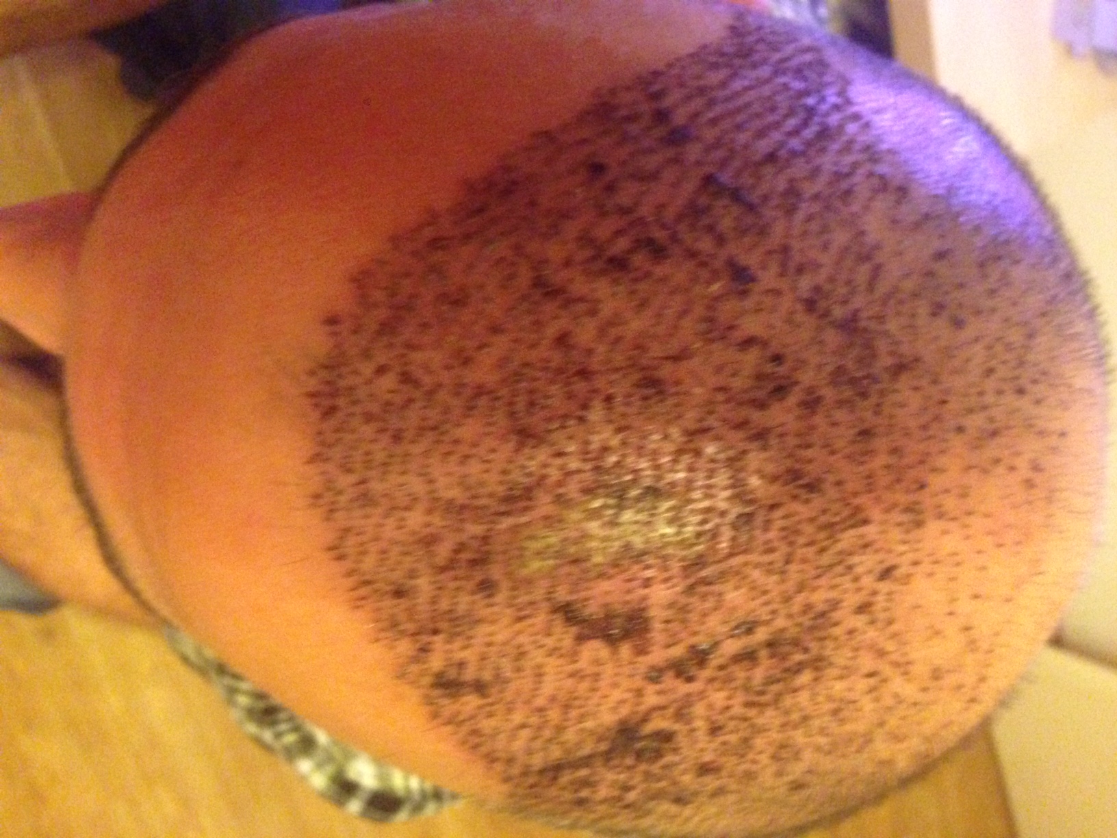 /foren/transplant/index.php?t=getfile&id=42082&private=0