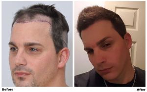 /foren/transplant/index.php?t=getfile&id=42264&private=0